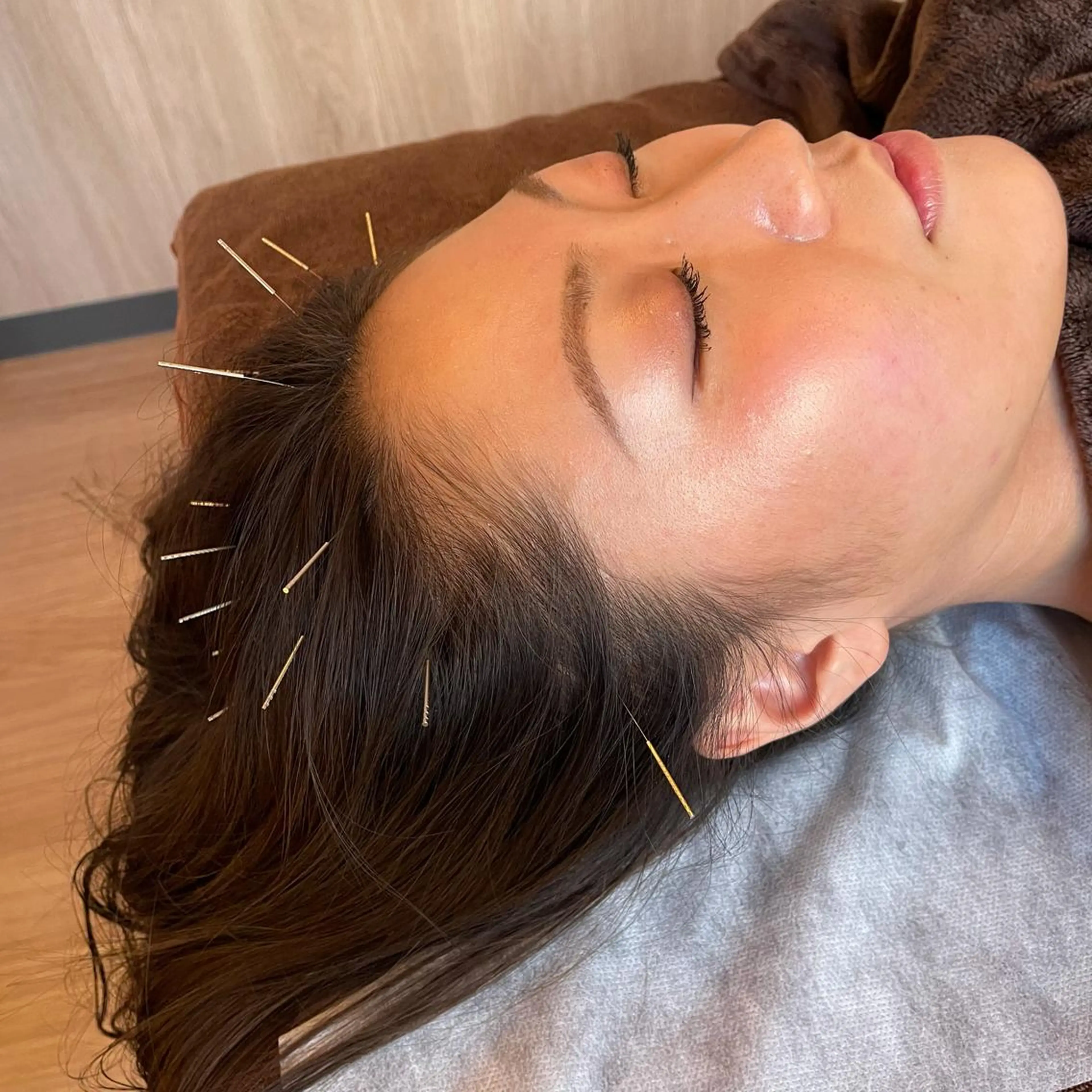 美髪鍼コース［髪の毛のハリやコシ、白髪が気になる方にオススメ！頭皮と身体をほぐし血流改善します］の写真