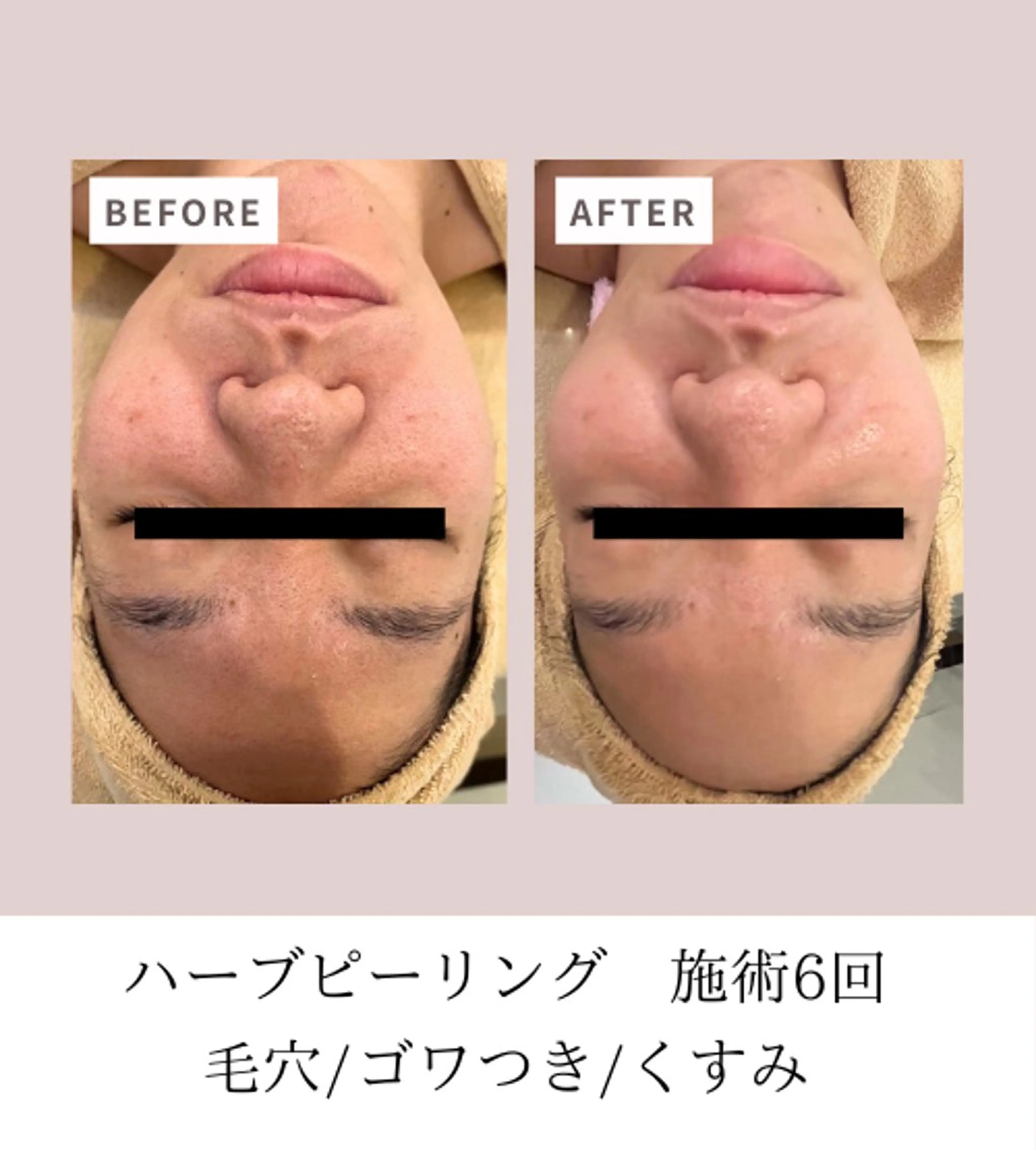 Men's Lab所属・武田 麻里のエステ・リラクイメージ