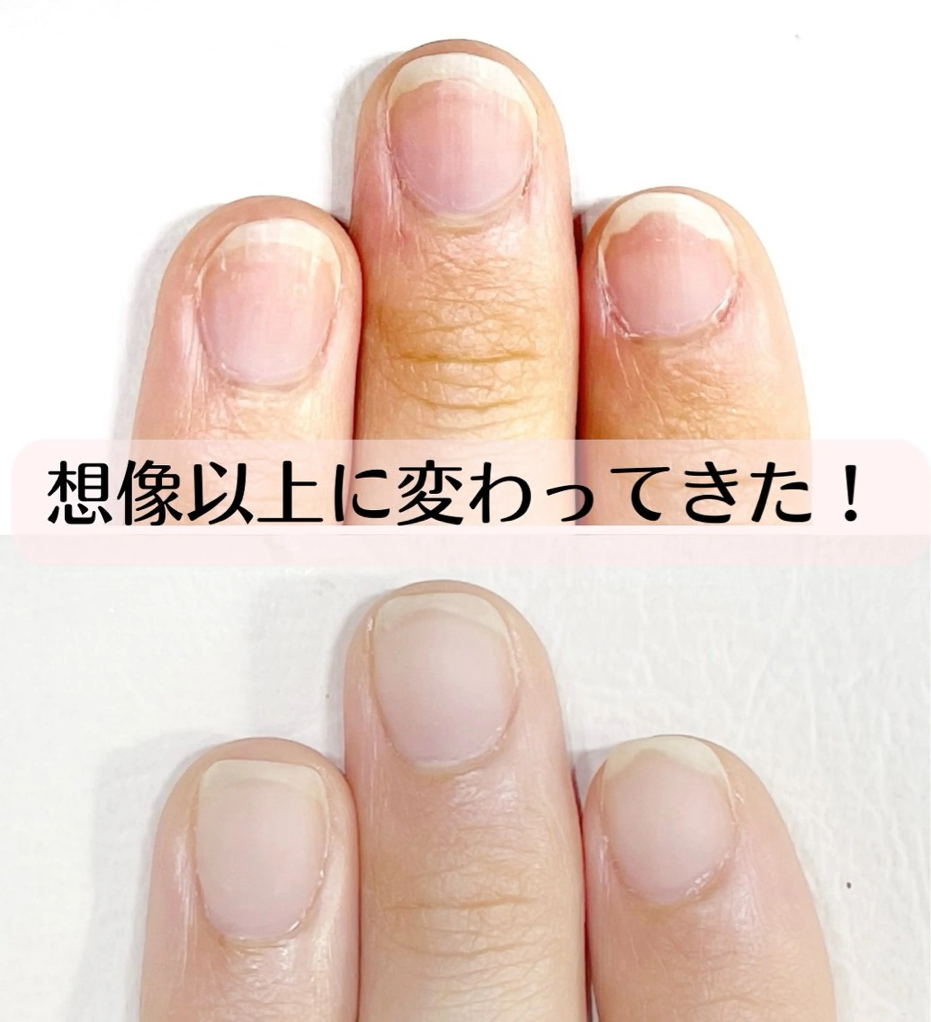 ネイル 深爪・巻き爪 専門サンセリテのネイルデザイン