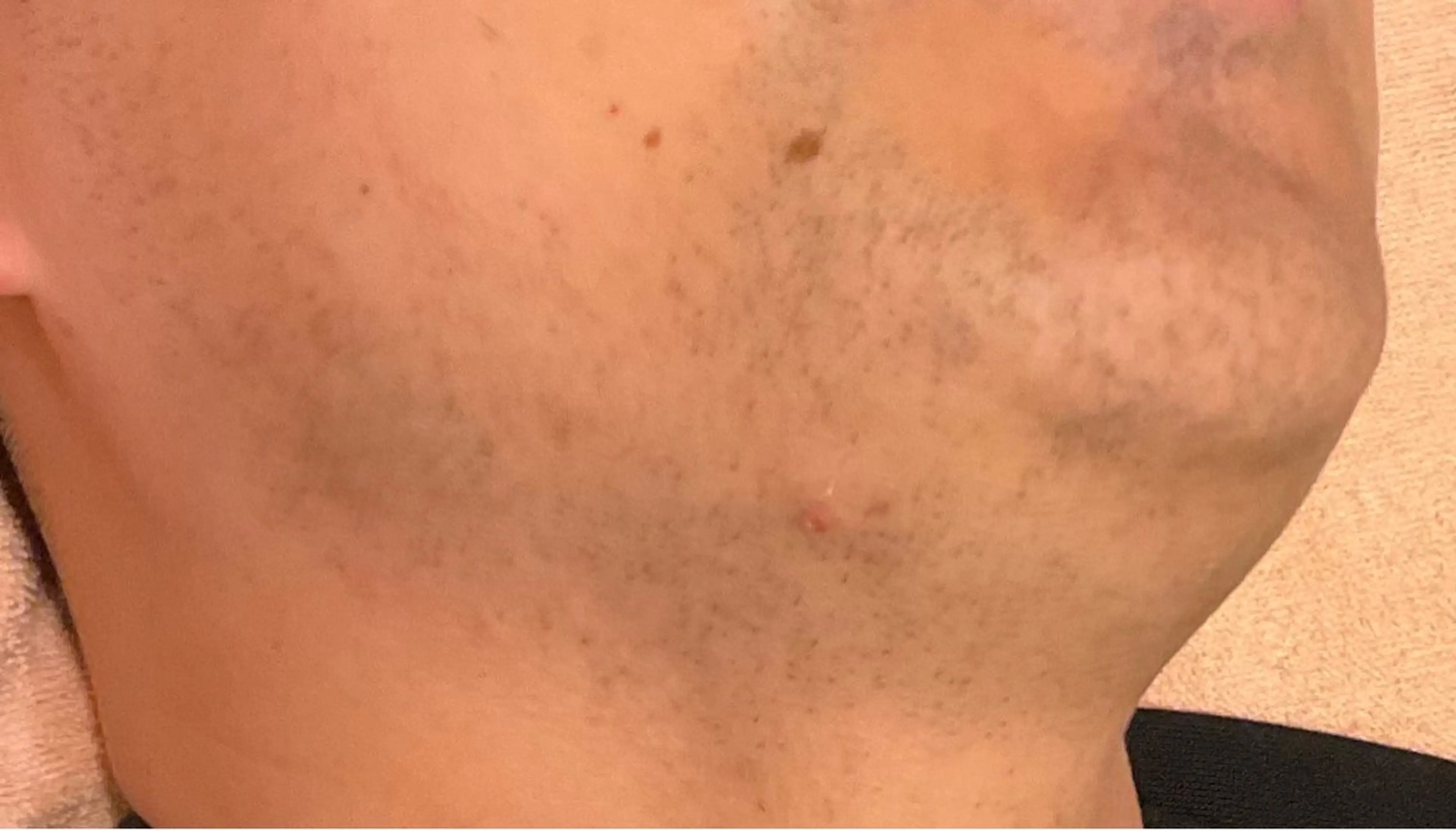 POPOのエステ所属・popoのエステ arisaのエステ・リラクイメージ