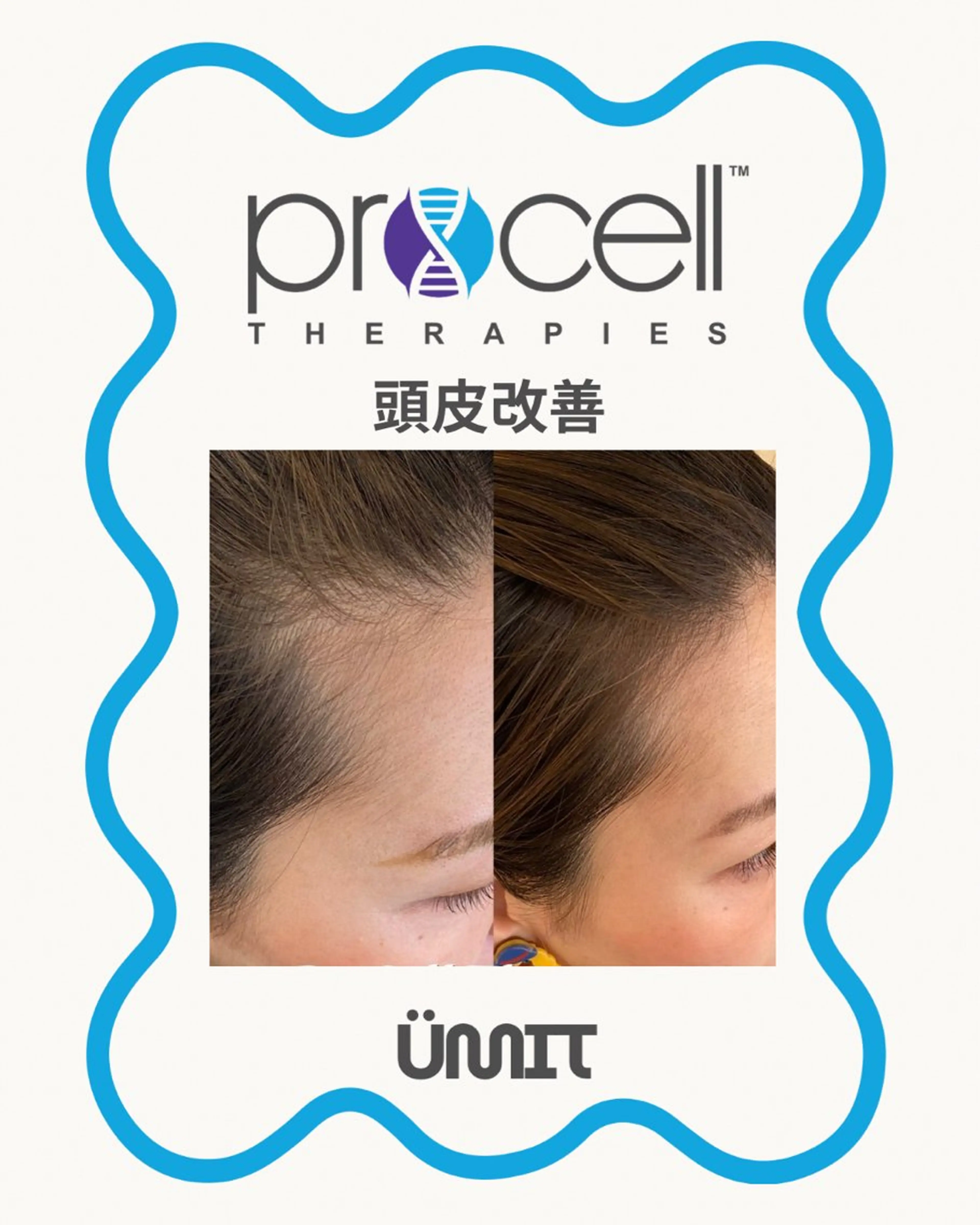 ヘッドスパ Ümit（ユミト） プロセルセラピーズのヘアスタイル