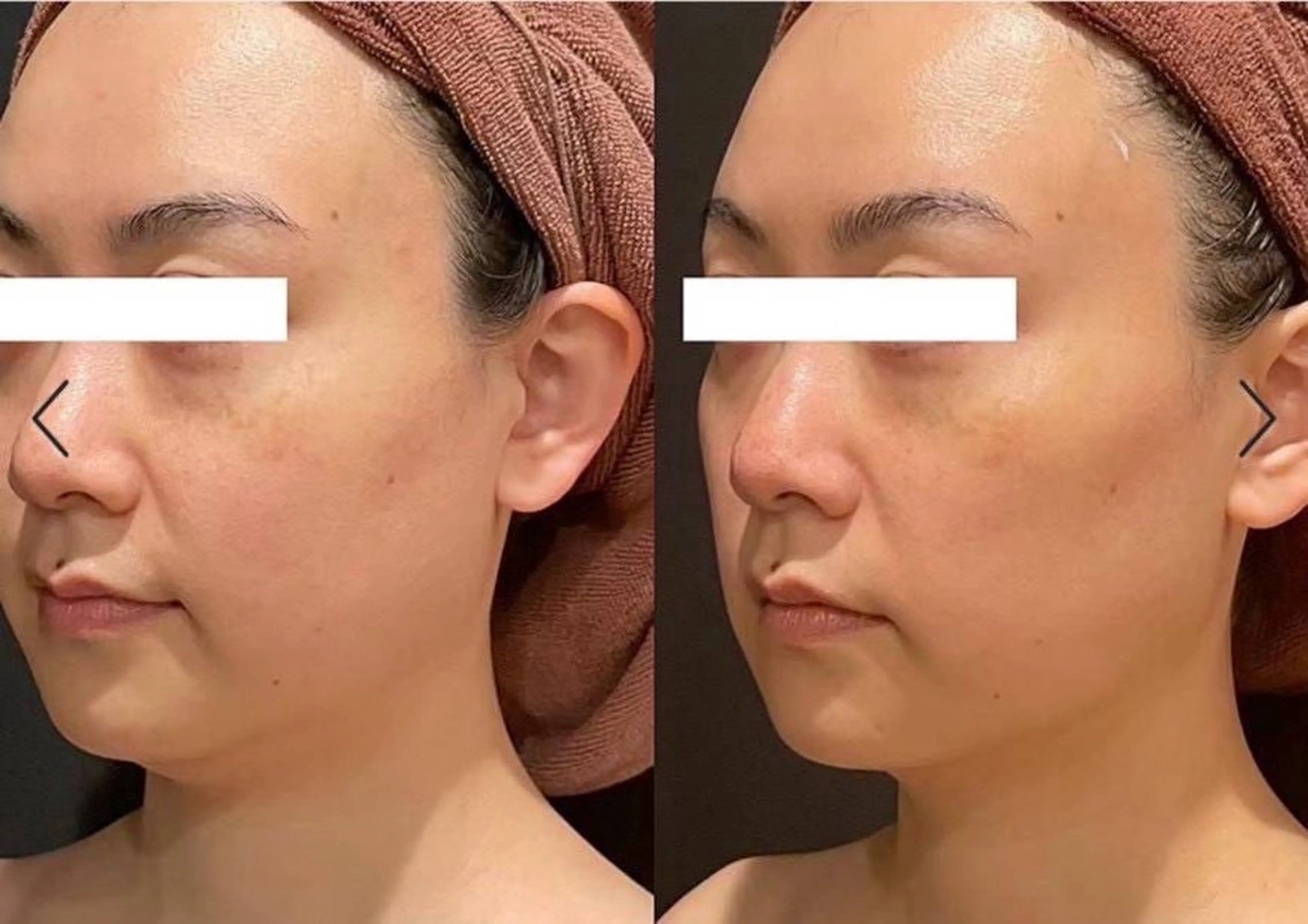 エステ 新宿南口 まどのエステ・リラクイメージ