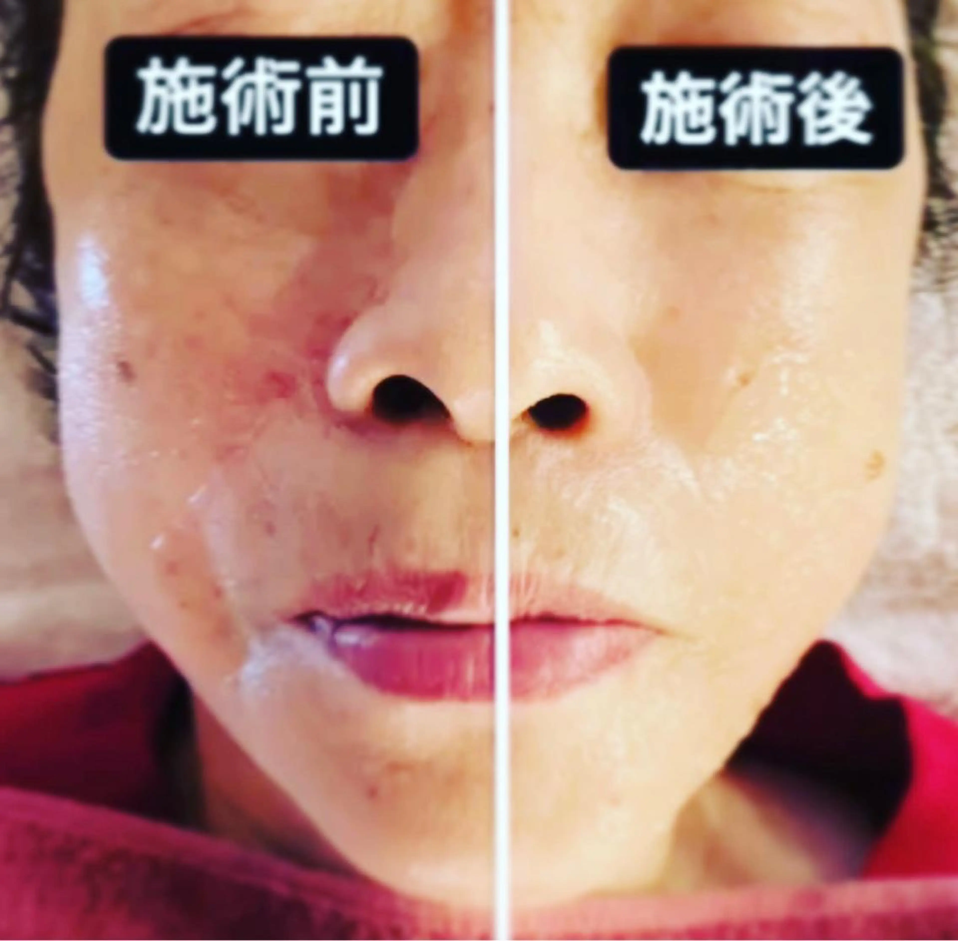 古民家サロン Berry大塚由貴のエステ・リラクイメージ