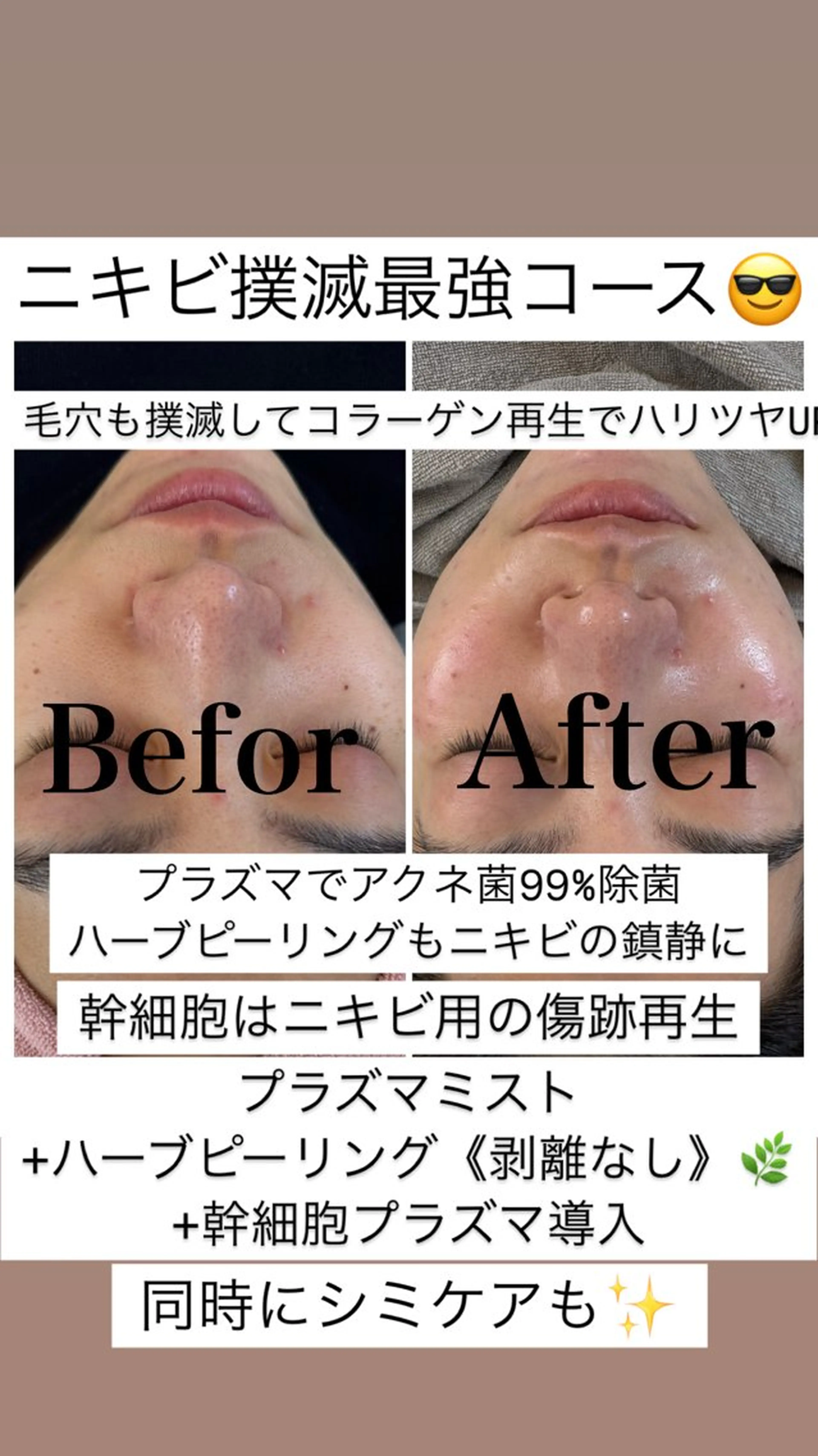 美肌管理サロン　ペルボヌール所属・韓国美肌管理サロン ペルボヌールのエステ・リラクイメージ