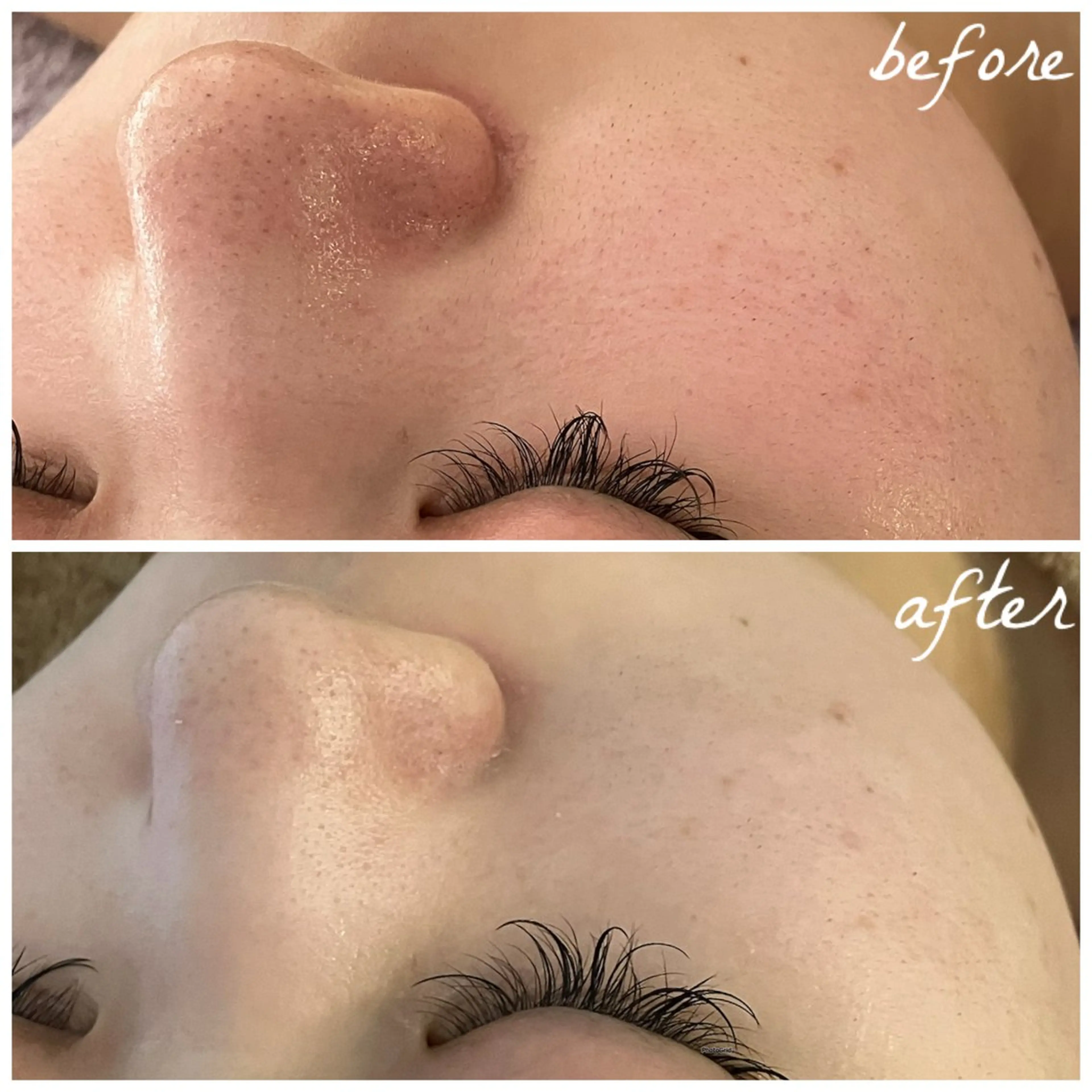 メンズ エステ メナード岐阜茜部 杉浦のエステ・リラクイメージ