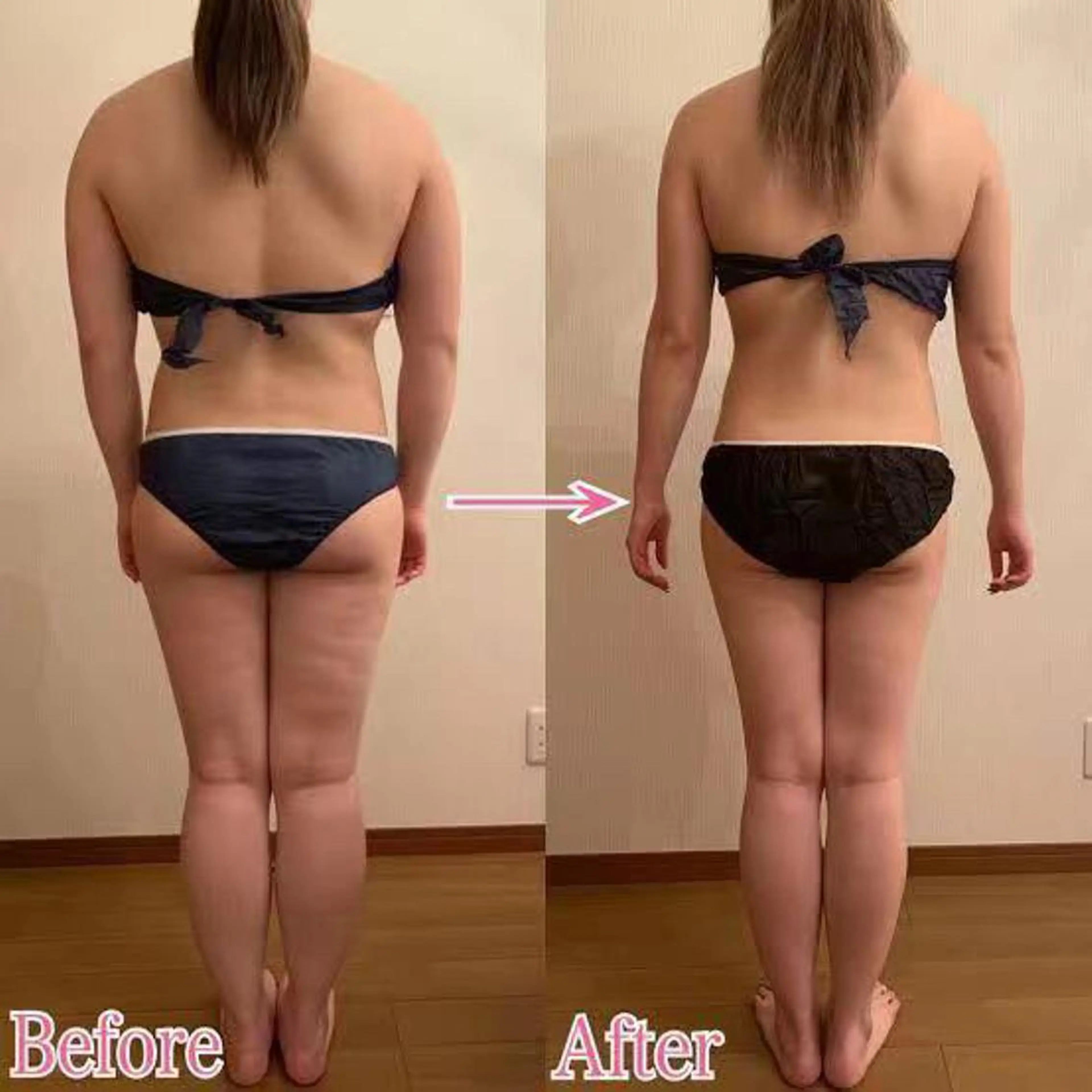 【痩身】みっちり90分!!キャビテーション＆ラジオ波＆吸引¥20,000の写真