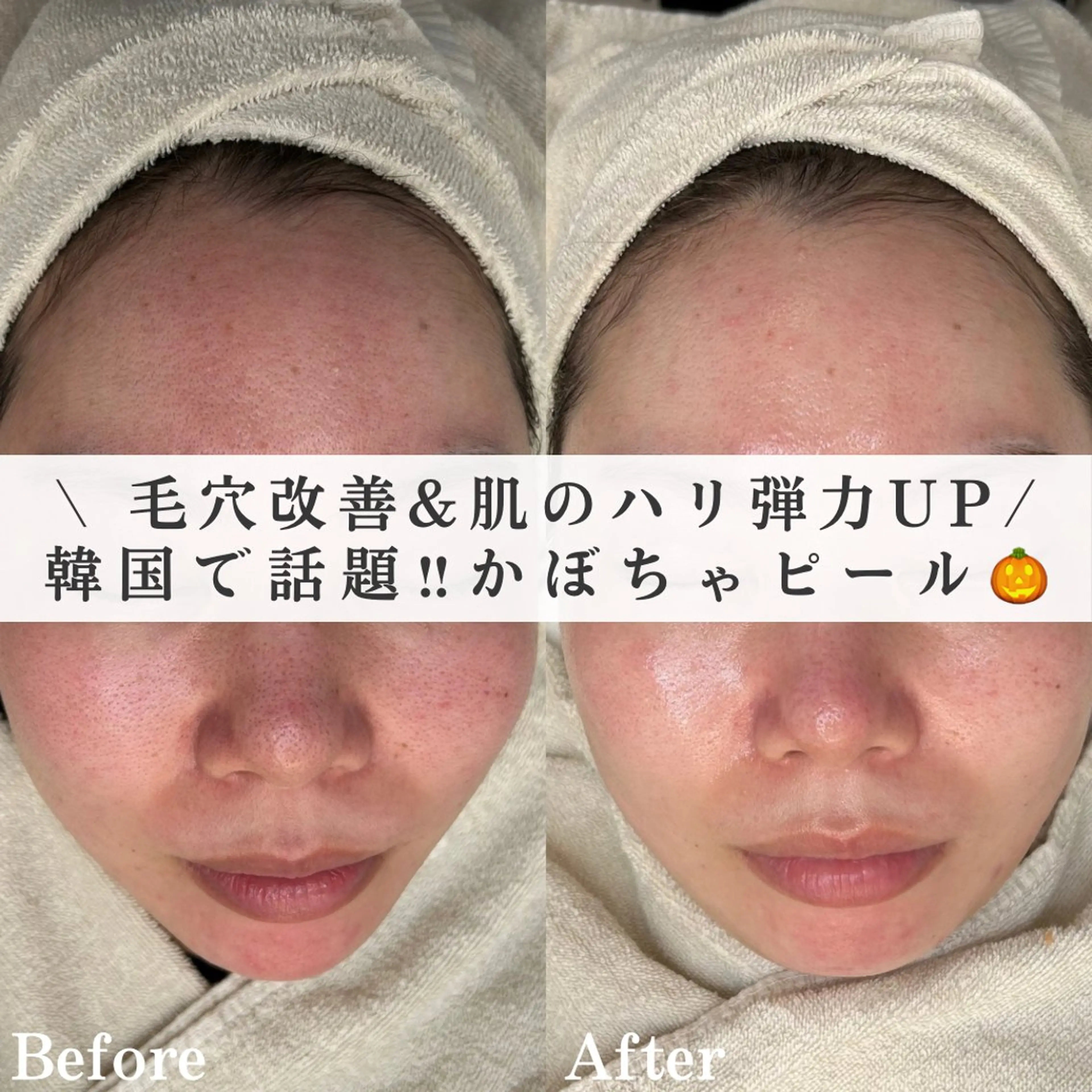 韓国肌管理&小顔 ＩＲＯＨＡのエステ・リラクイメージ