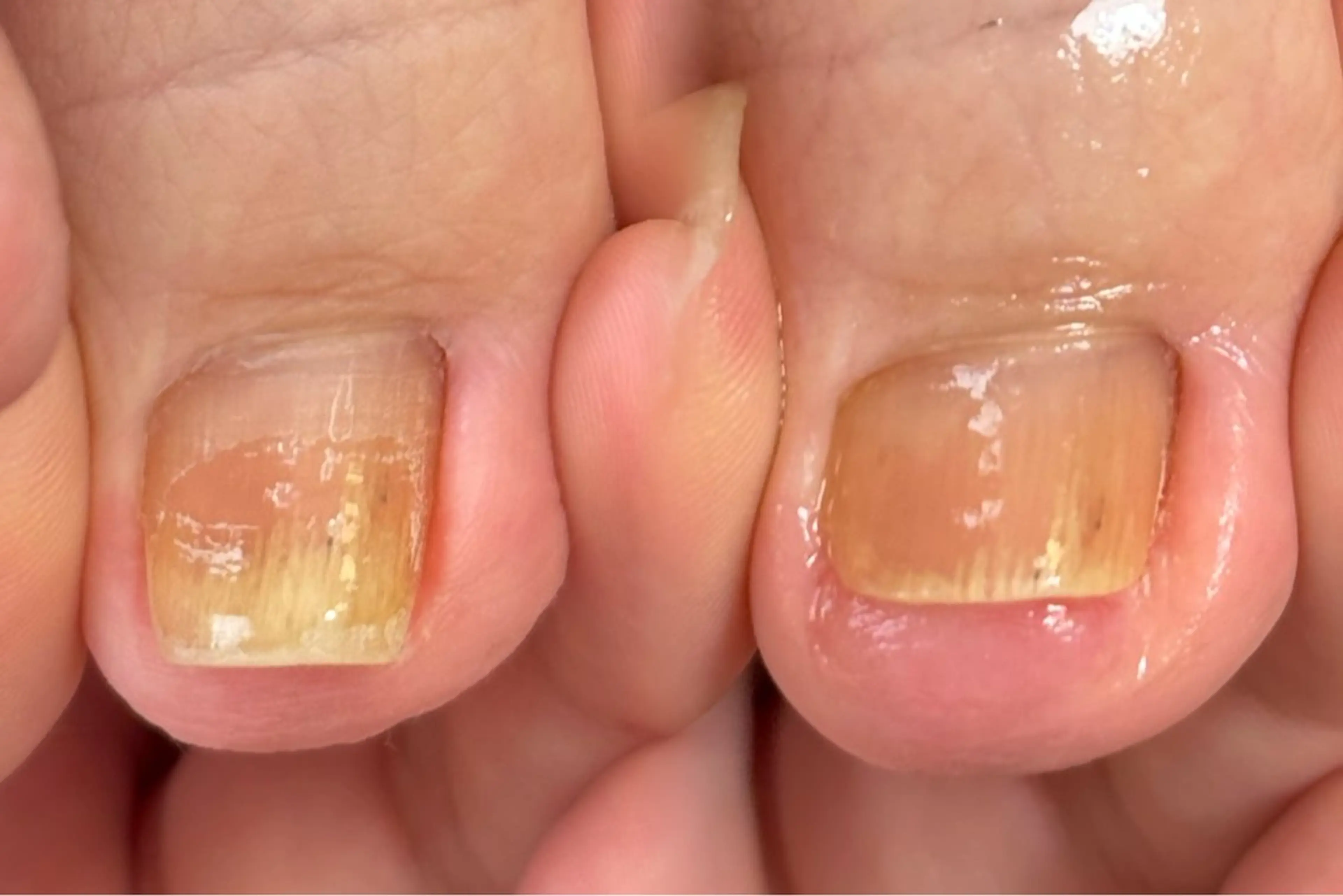 フットケア👣の写真