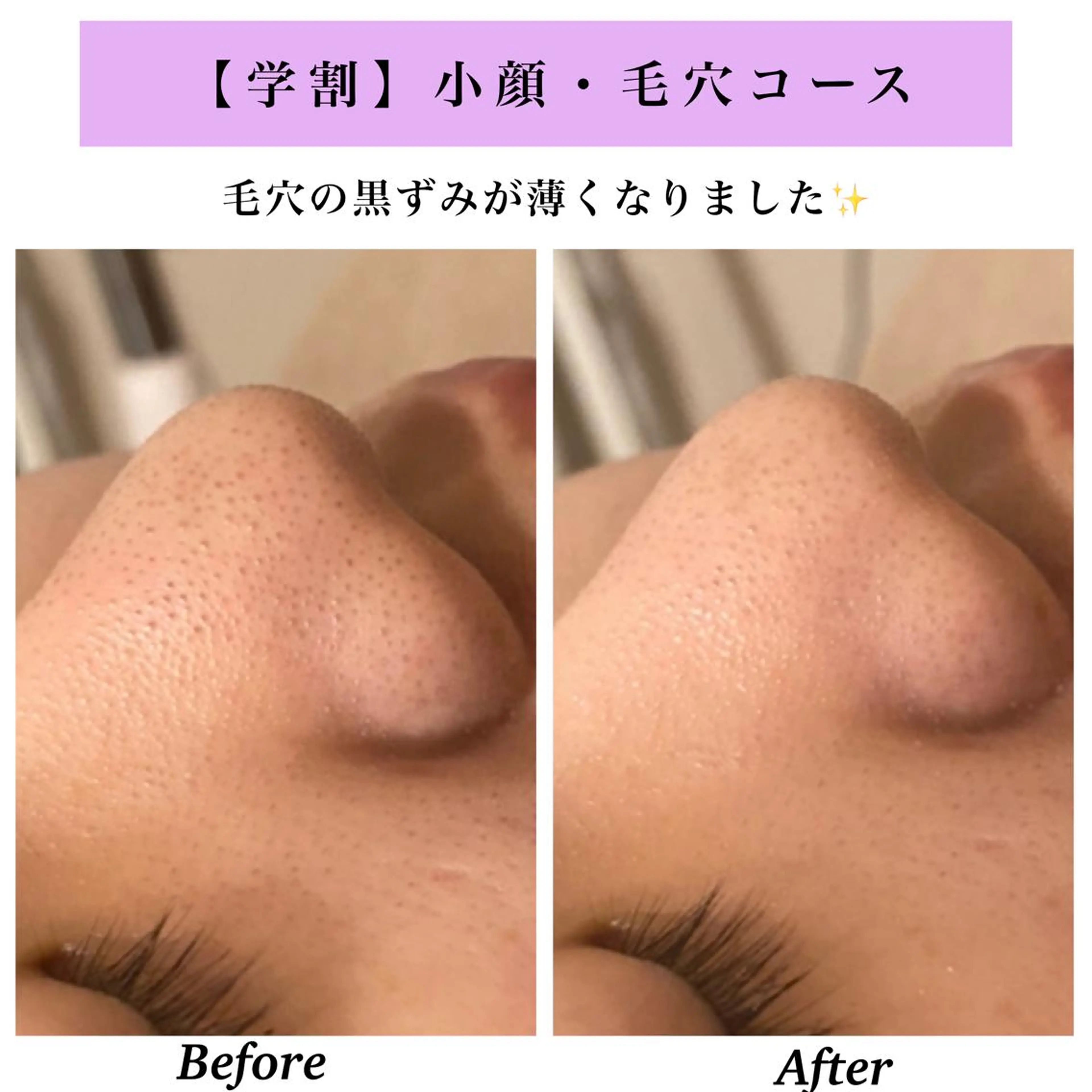 Bellesthe （ベルエステ）のエステ・リラクイメージ