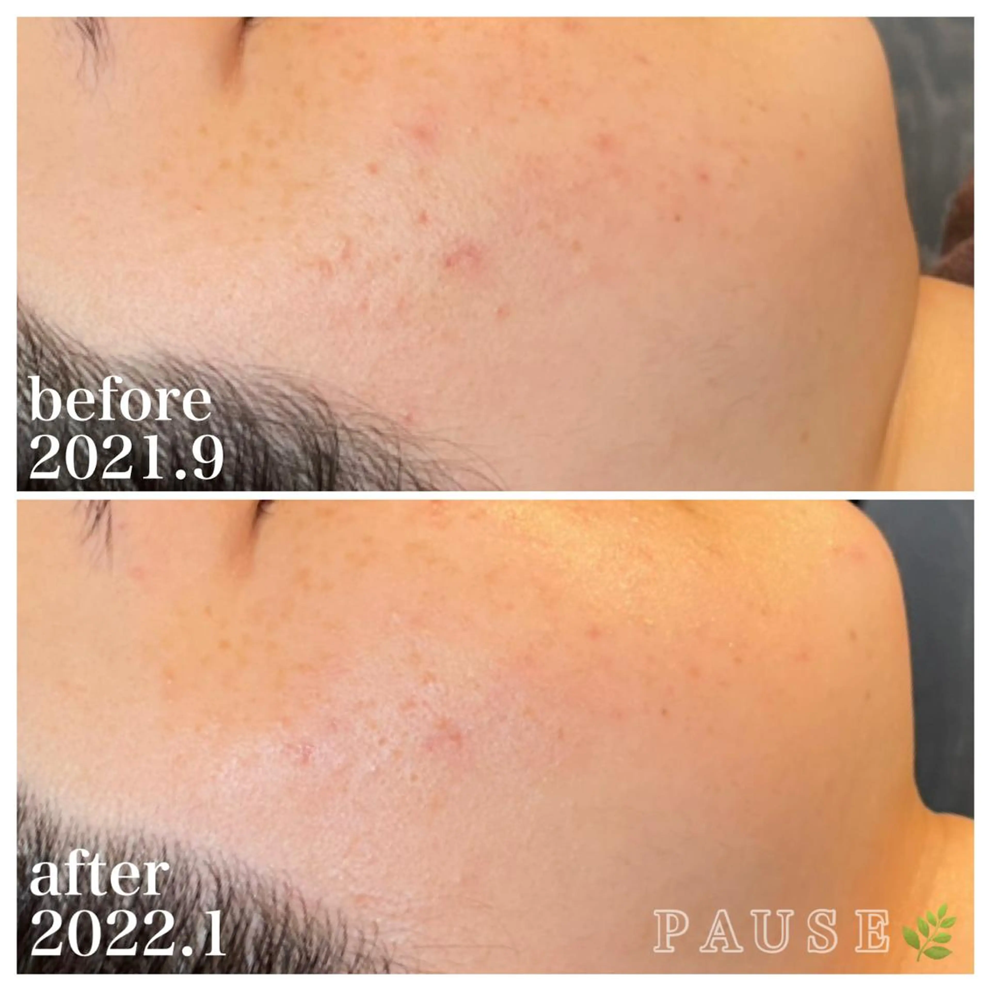 エステ 浜野 恵美のエステ・リラクイメージ