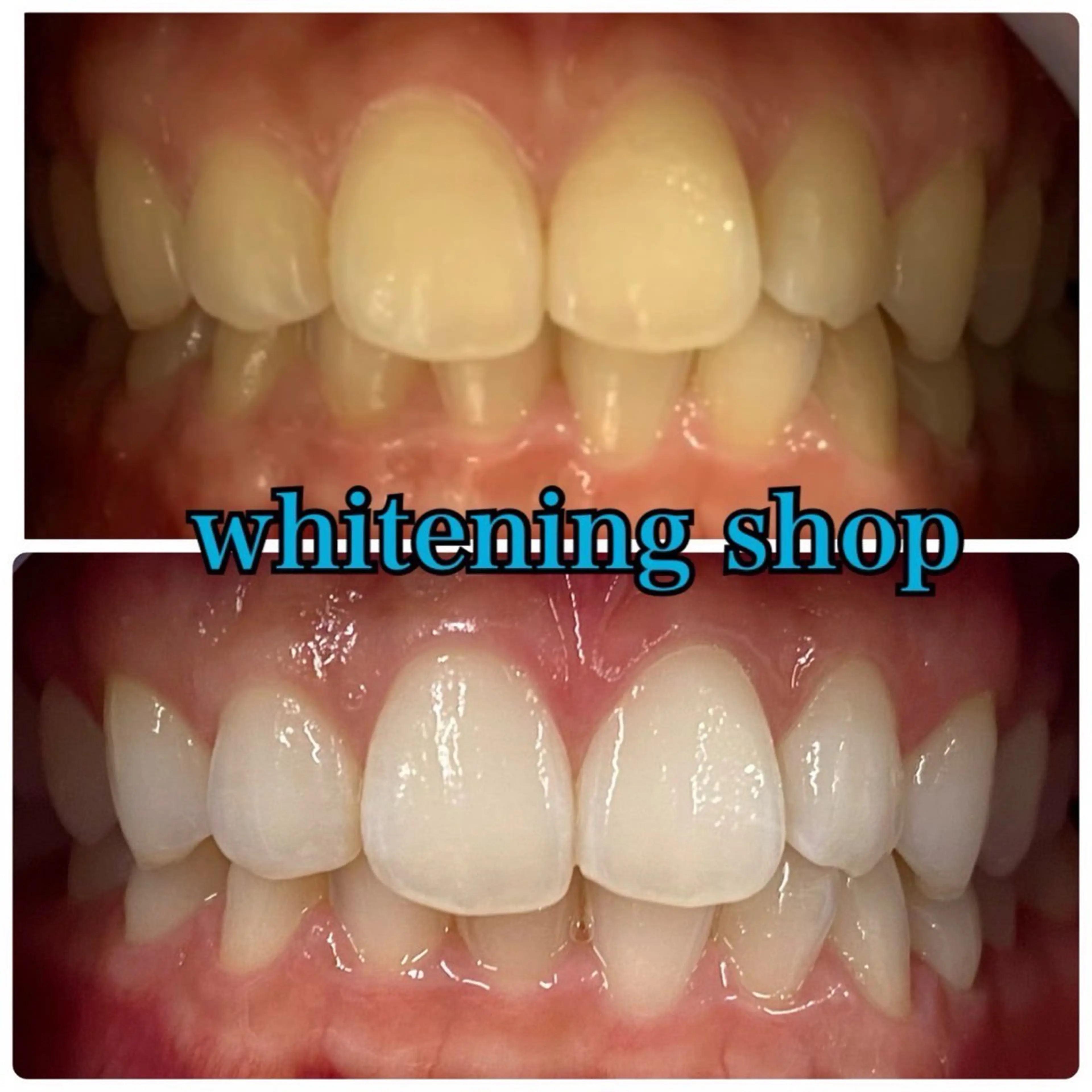 メンズ エステ リラク ホワイトニング ショップ川越店のエステ・リラクイメージ