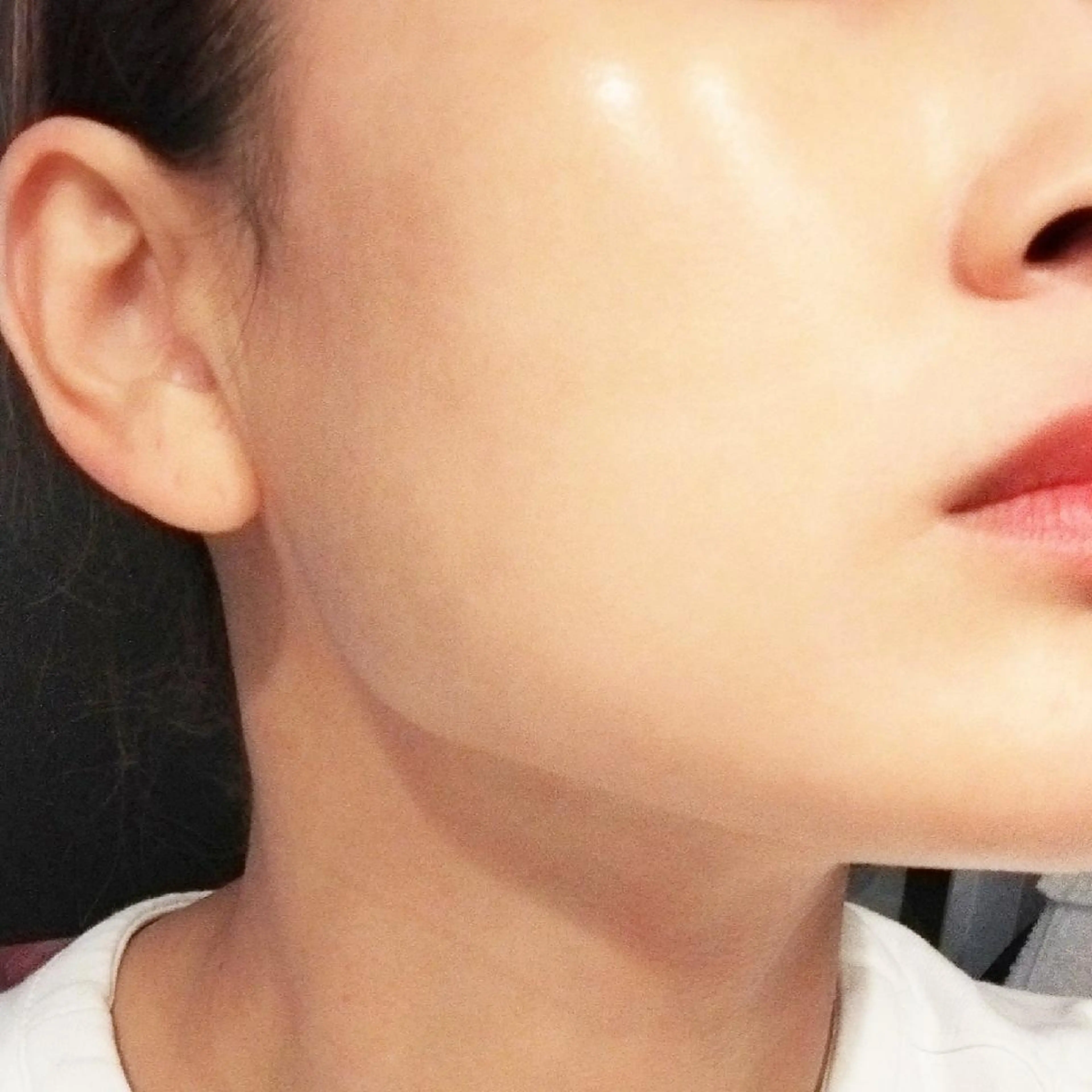 🉐シミが気になる！そんな方はこちら→美容のプロたちがみとめる金賞受賞の最新幹細胞ハーブトリートメント　1.5㌘の写真