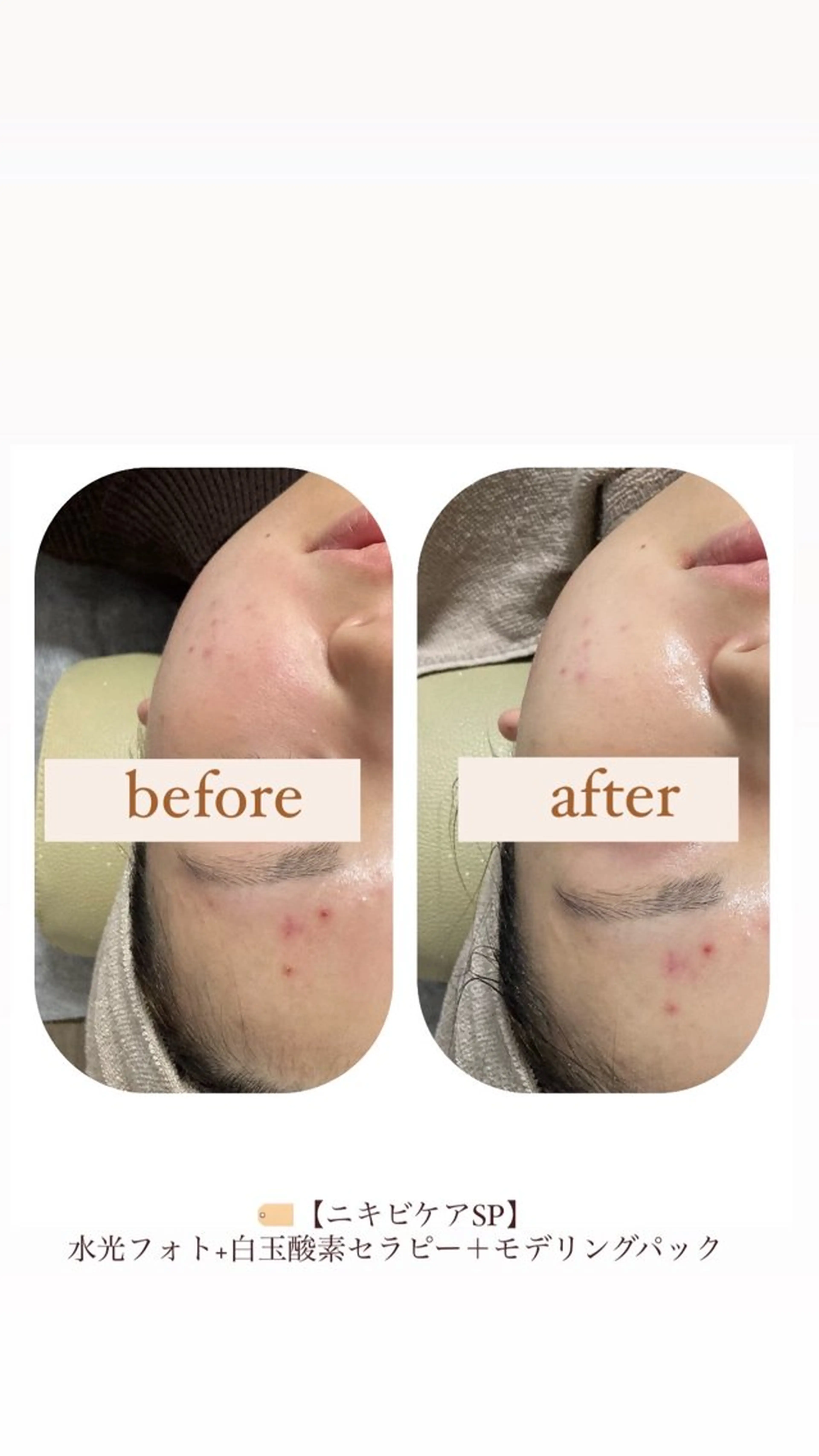 エステ crescent所属・【韓国肌管理・脱毛】 クレセントのその他イメージ