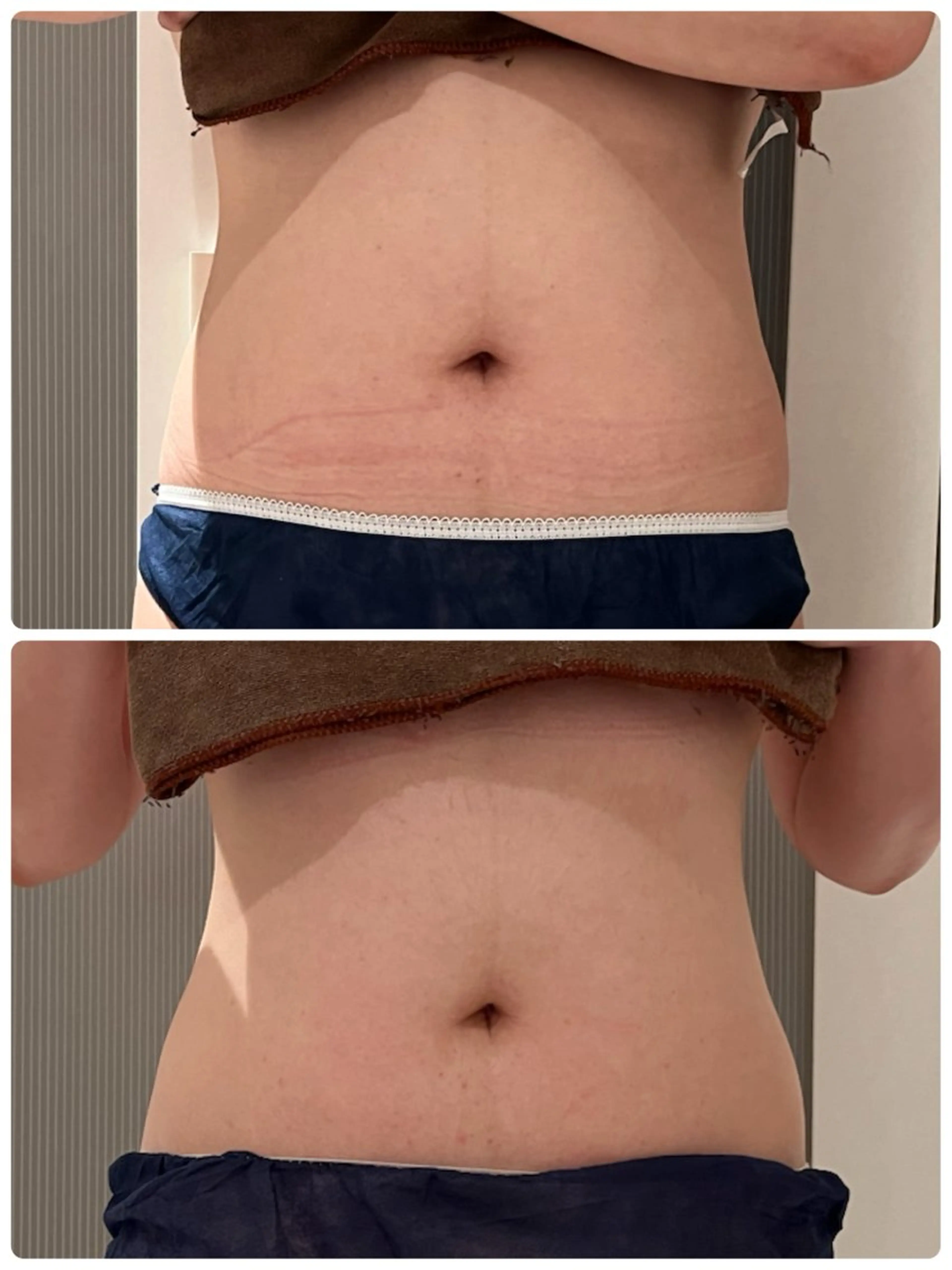 Folche所属・Folcheはません 森山のエステ・リラクイメージ