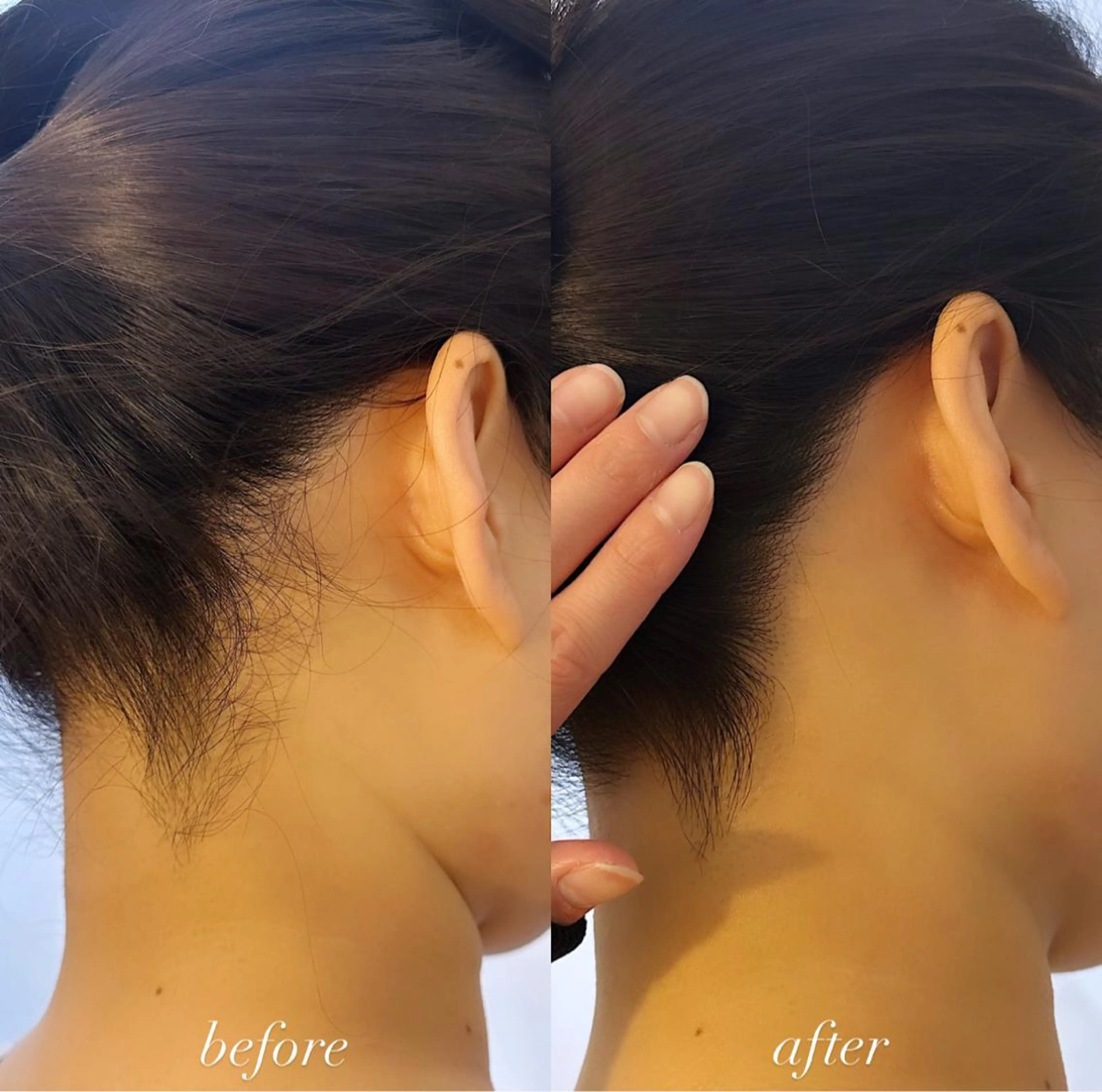 うなじ脱毛/美肌脱毛 LABELのエステ・リラクイメージ