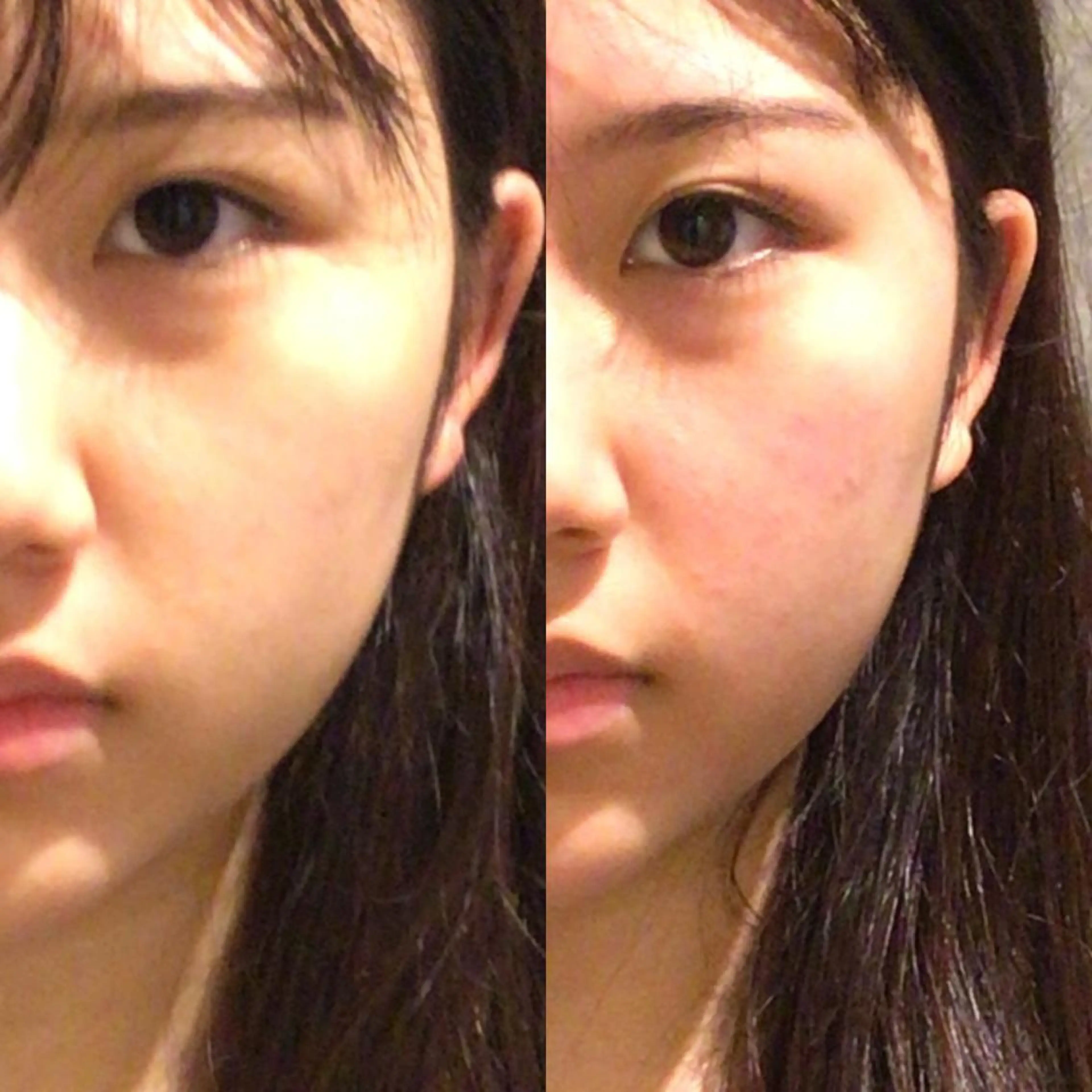 目黒/小顔/骨盤/ 美容鍼/美顔鍼/小林のエステ・リラクイメージ