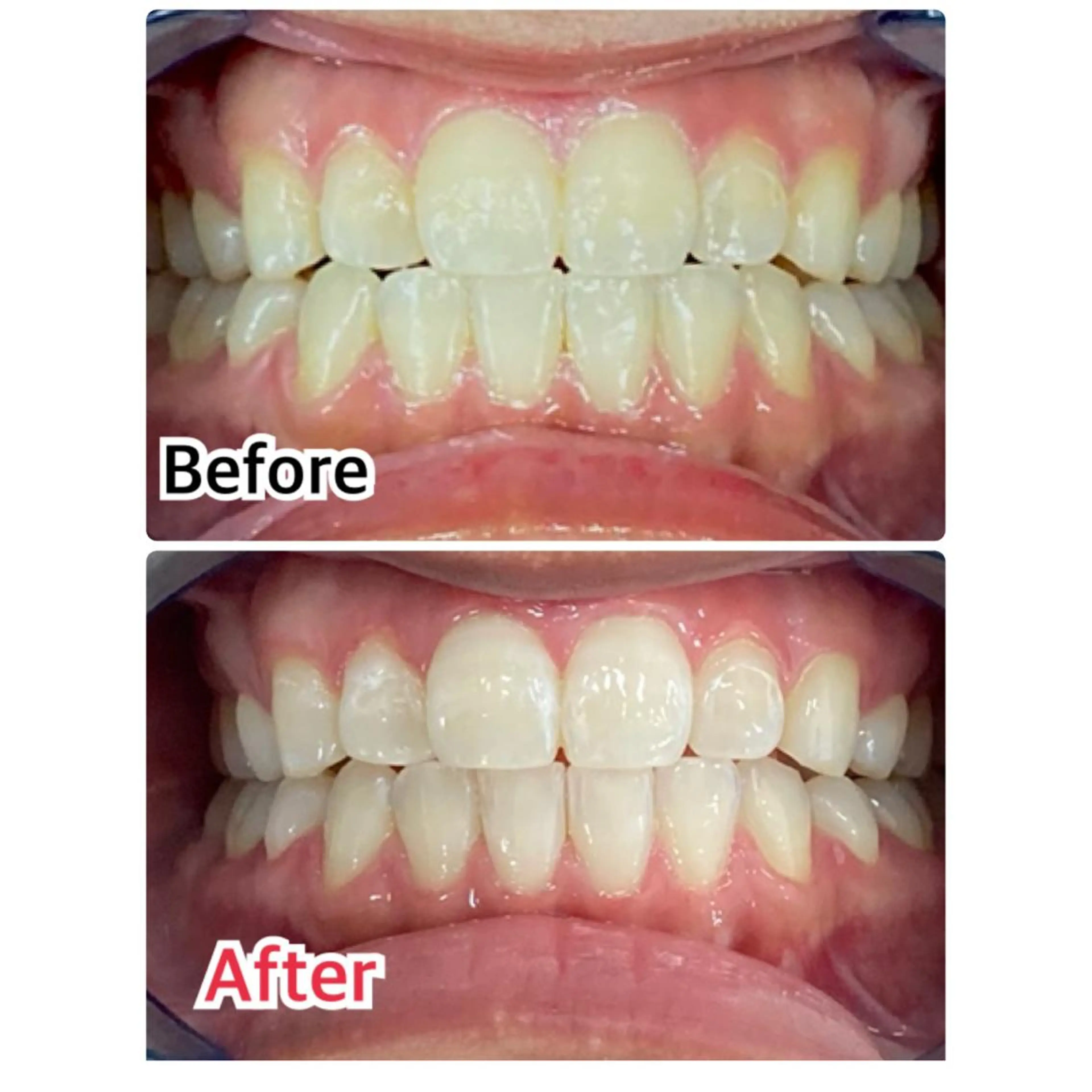 プラチナムビューティー柏所属・【歯科提携】柏ホワイ トニングスタイルのその他イメージ