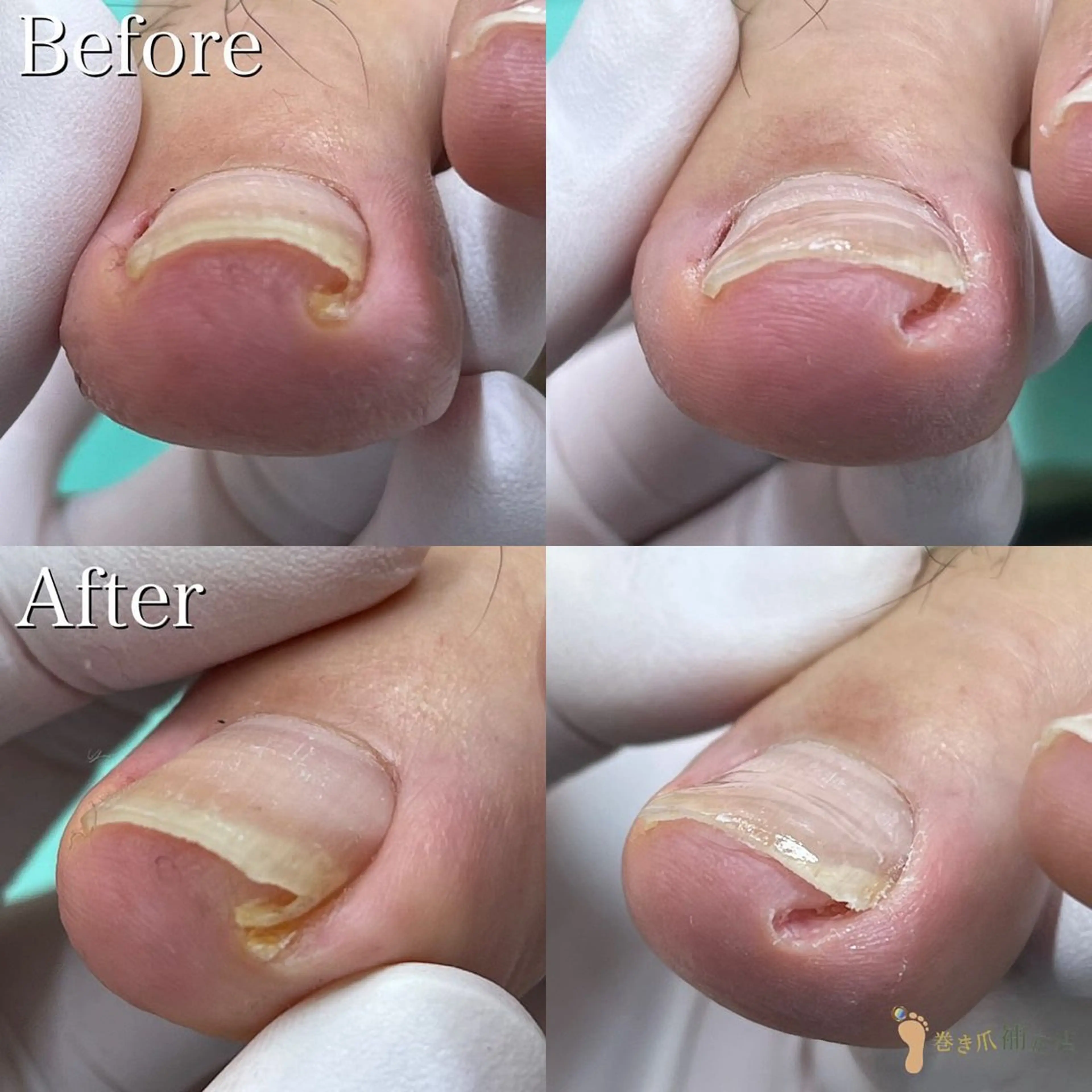 ネイル 大宮巻き爪補正店所属・大宮 巻き爪補正店のエステ・リラクイメージ