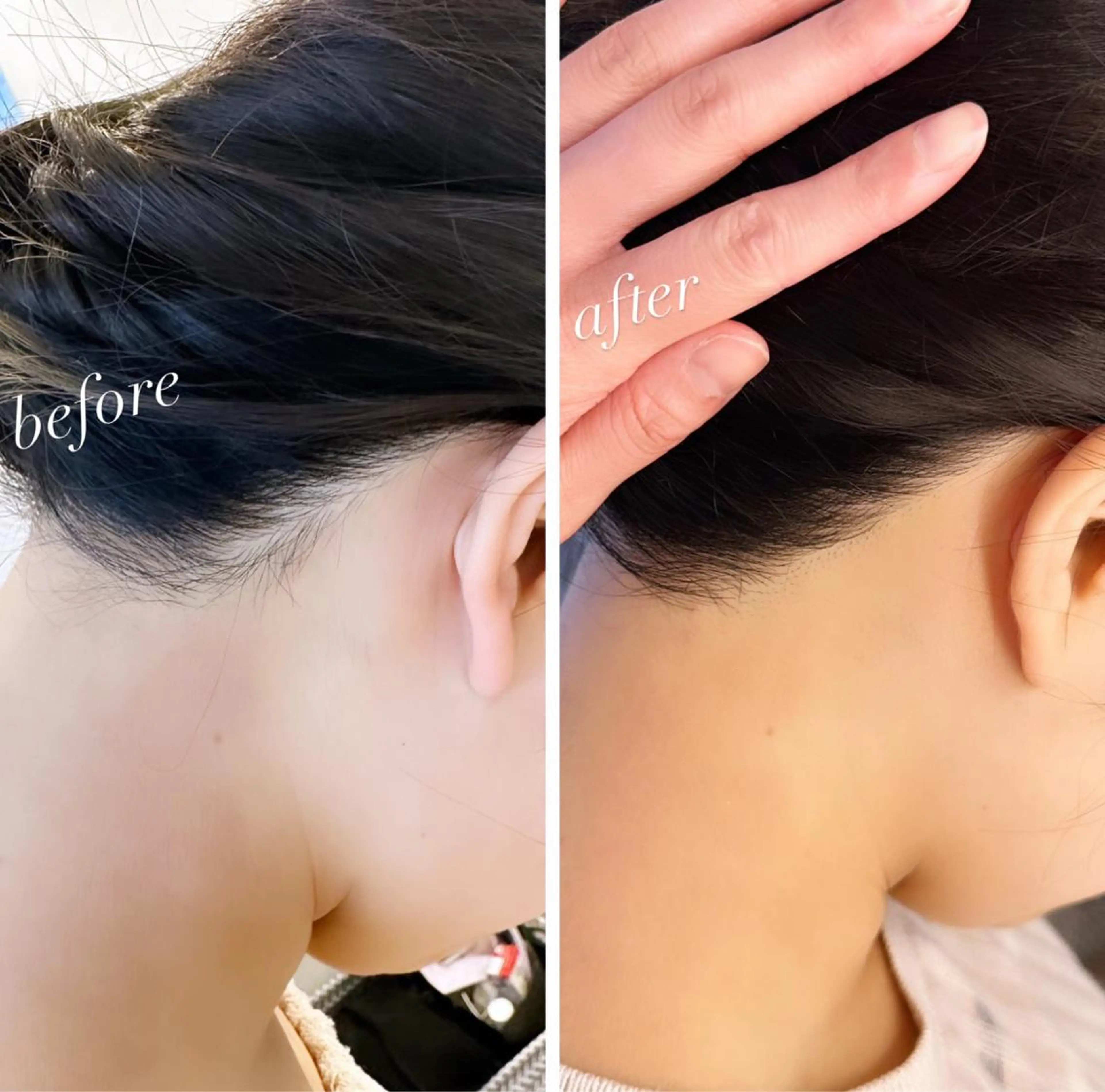 うなじ脱毛/美肌脱毛 LABELのエステ・リラクイメージ