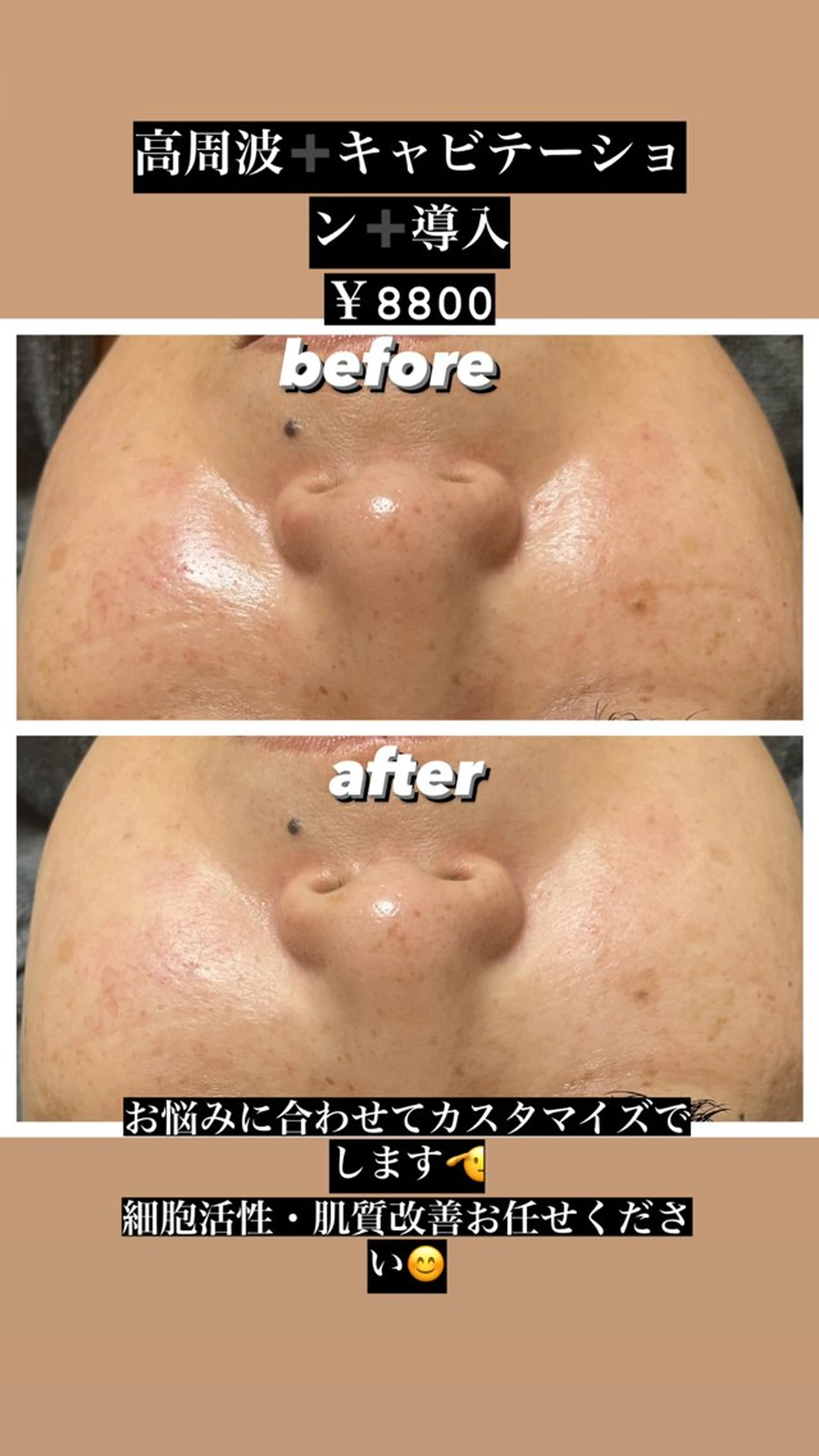 エステ perky所属・perky 羽島のマツエク・マツパデザイン