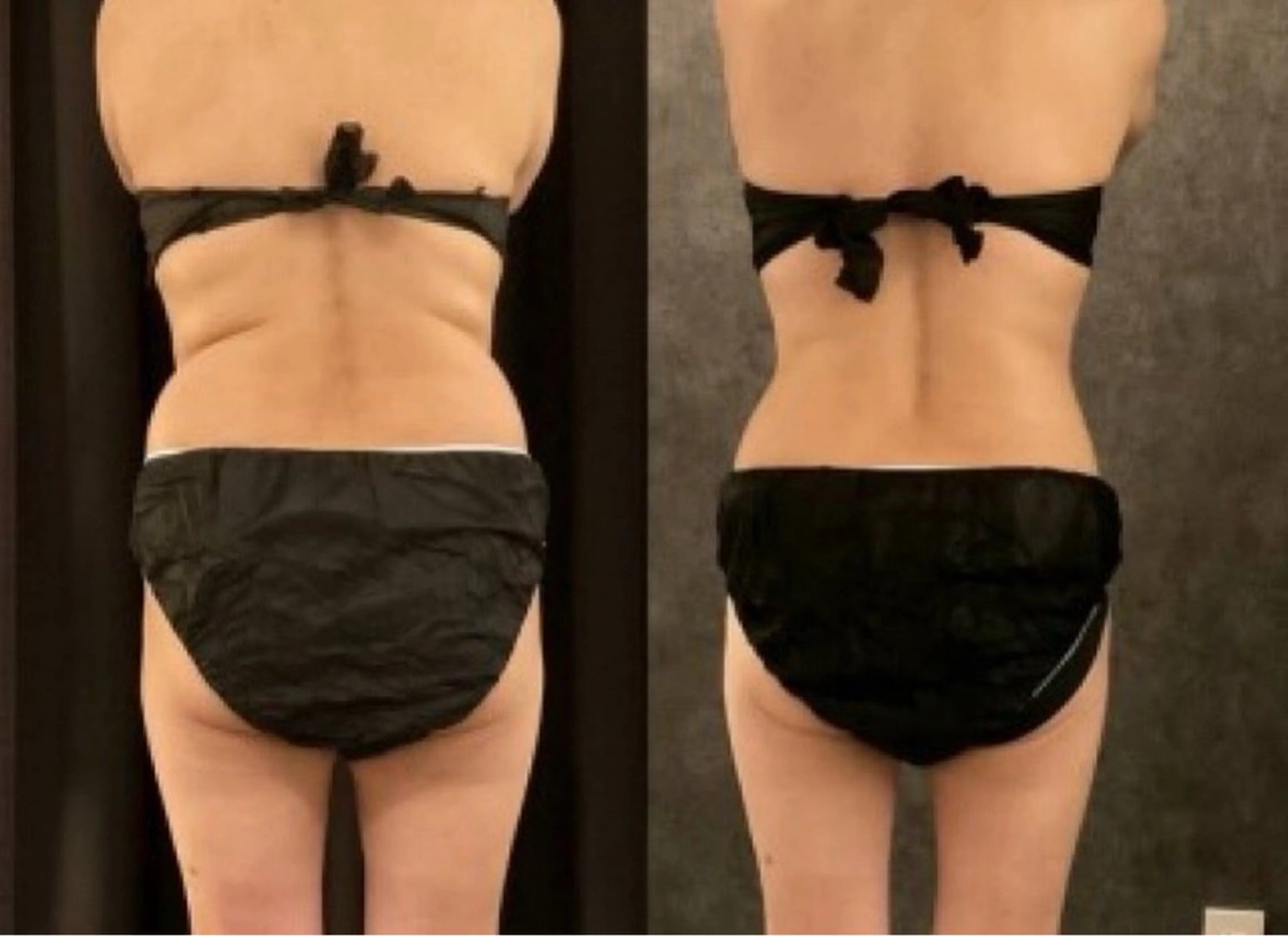 マツエク・マツパ エステ リラク 愛維美水光美肌専門店所属・愛維美水光美肌専門店 メンズレディースokのエステ・リラクイメージ