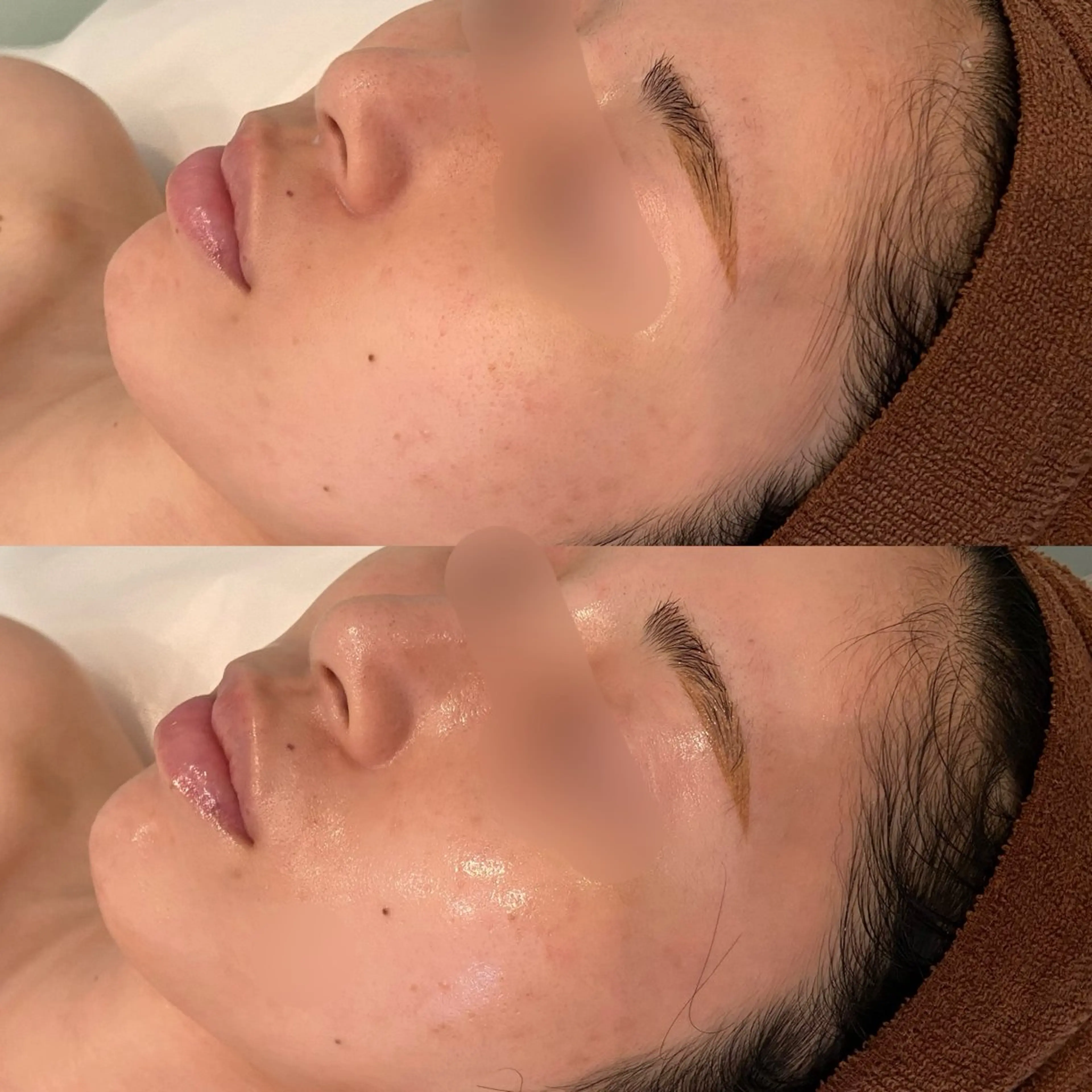 エステ ハーブピーリング専門 BIOPLUS＋川崎のエステ・リラクイメージ