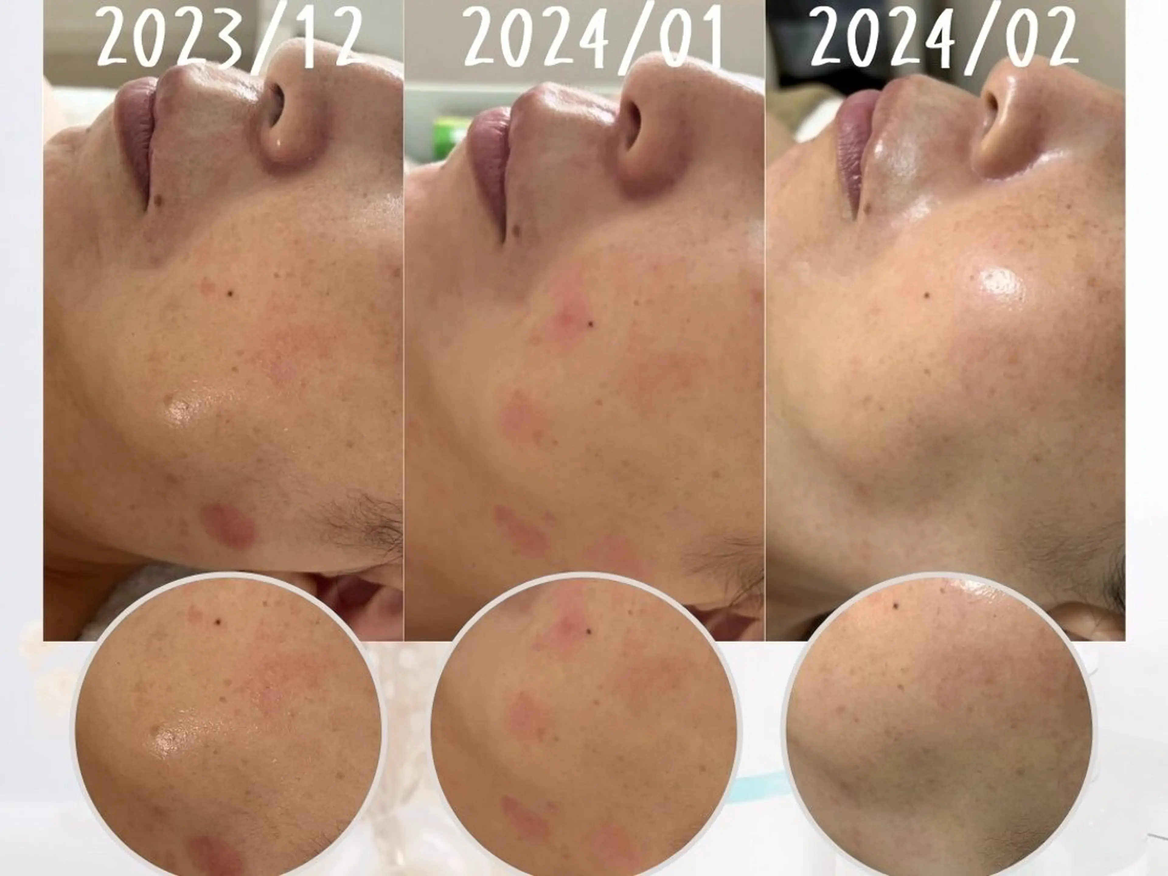 肌質改善|天王寺 For...はるかのエステ・リラクイメージ