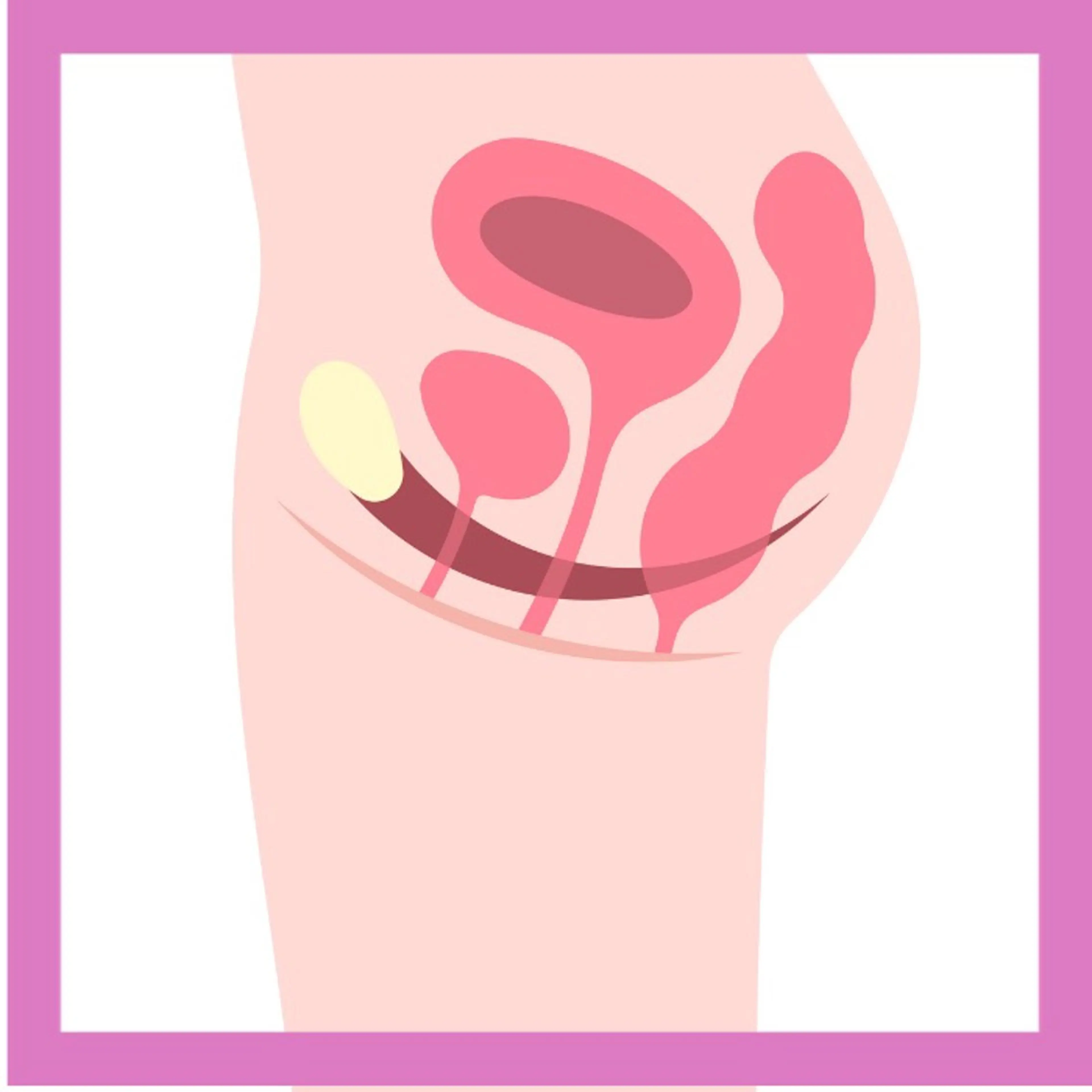 骨盤底筋を効率良く筋トレ♪の写真