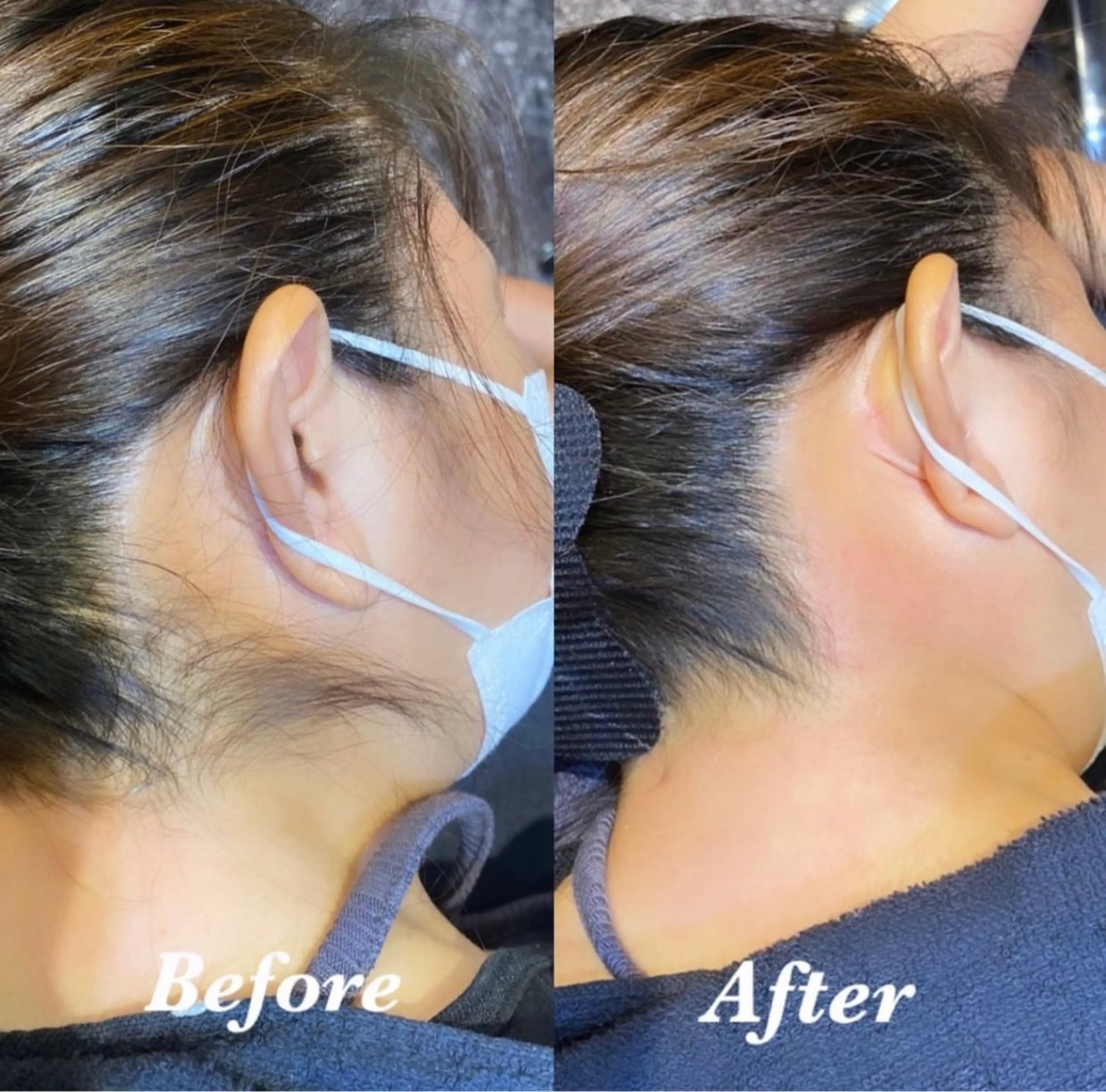 🚺🚹うなじWAXの写真