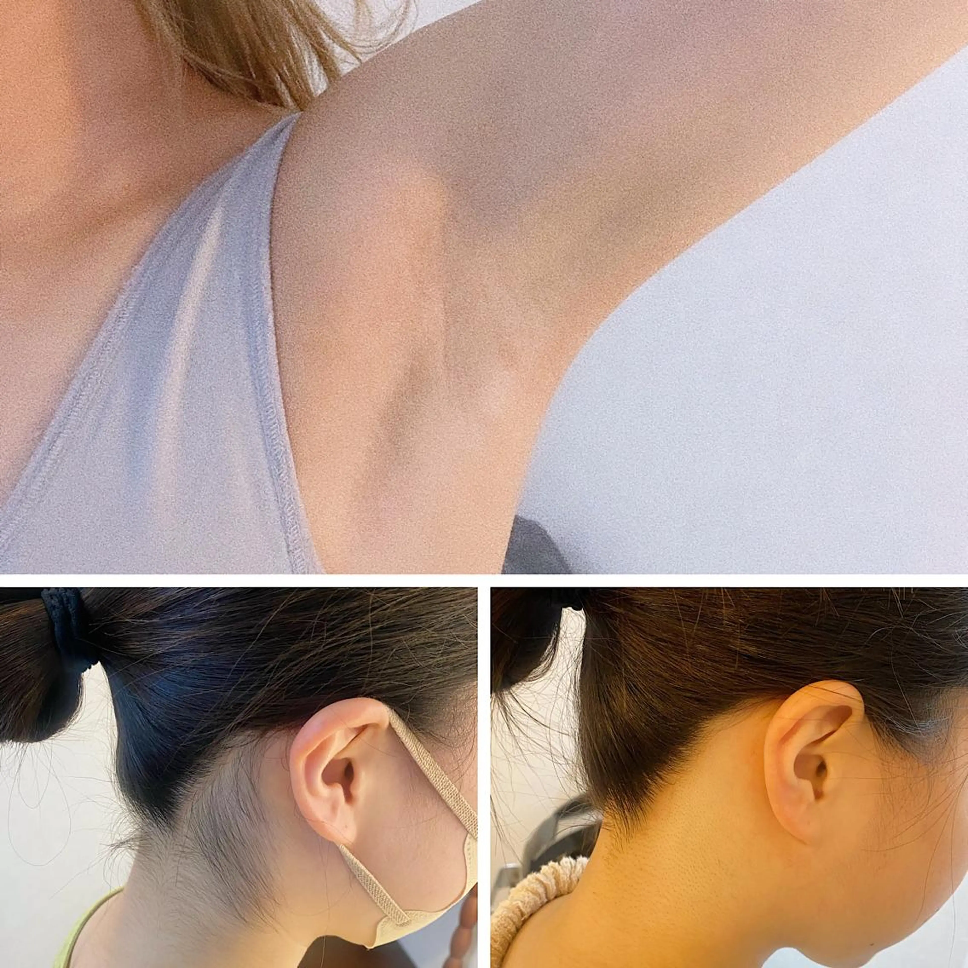 脱毛 うなじ脱毛/美肌脱毛 LABELのエステ・リラクイメージ