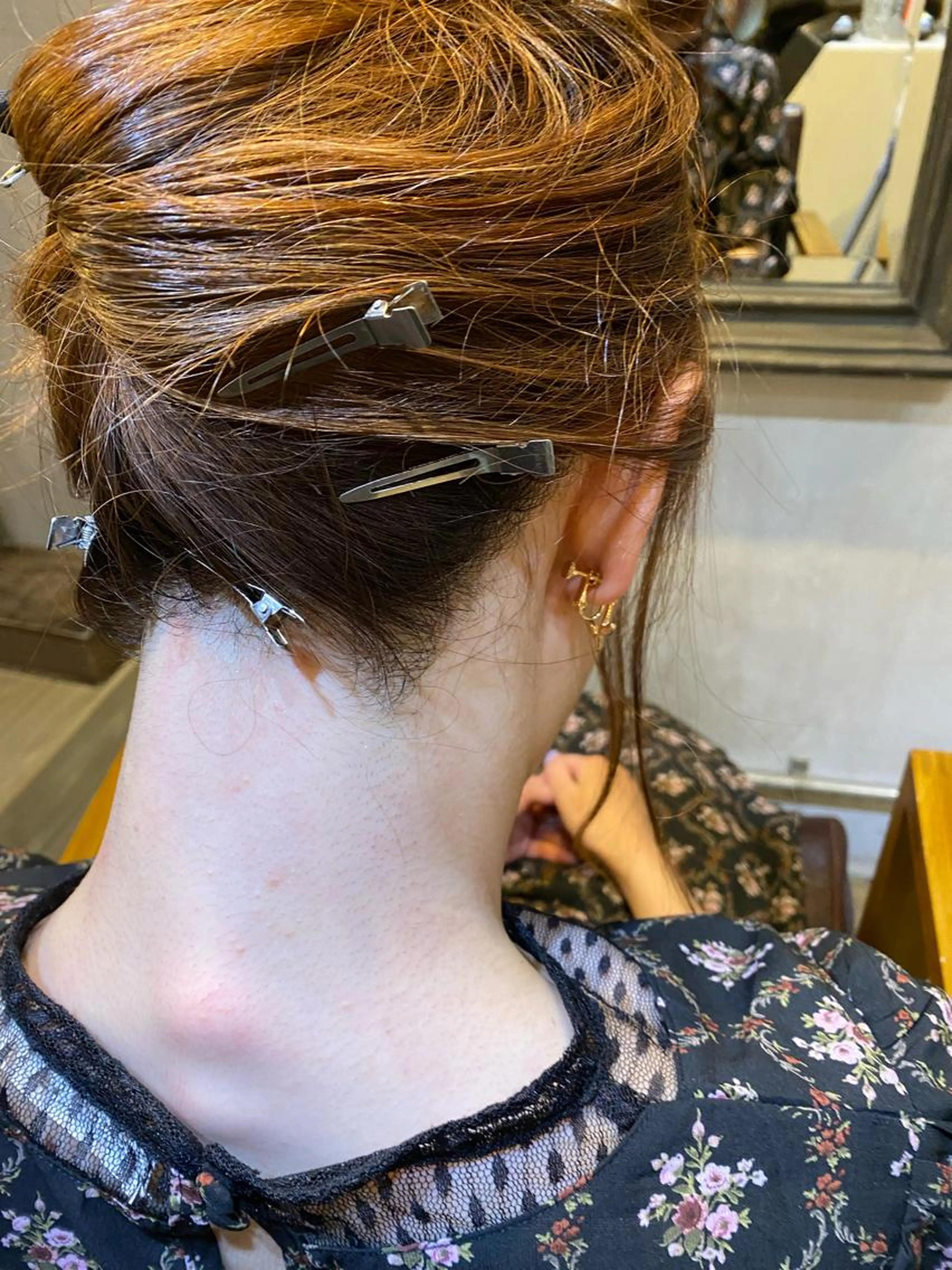 750円お得✨【５回コース】うなじ脱毛の写真