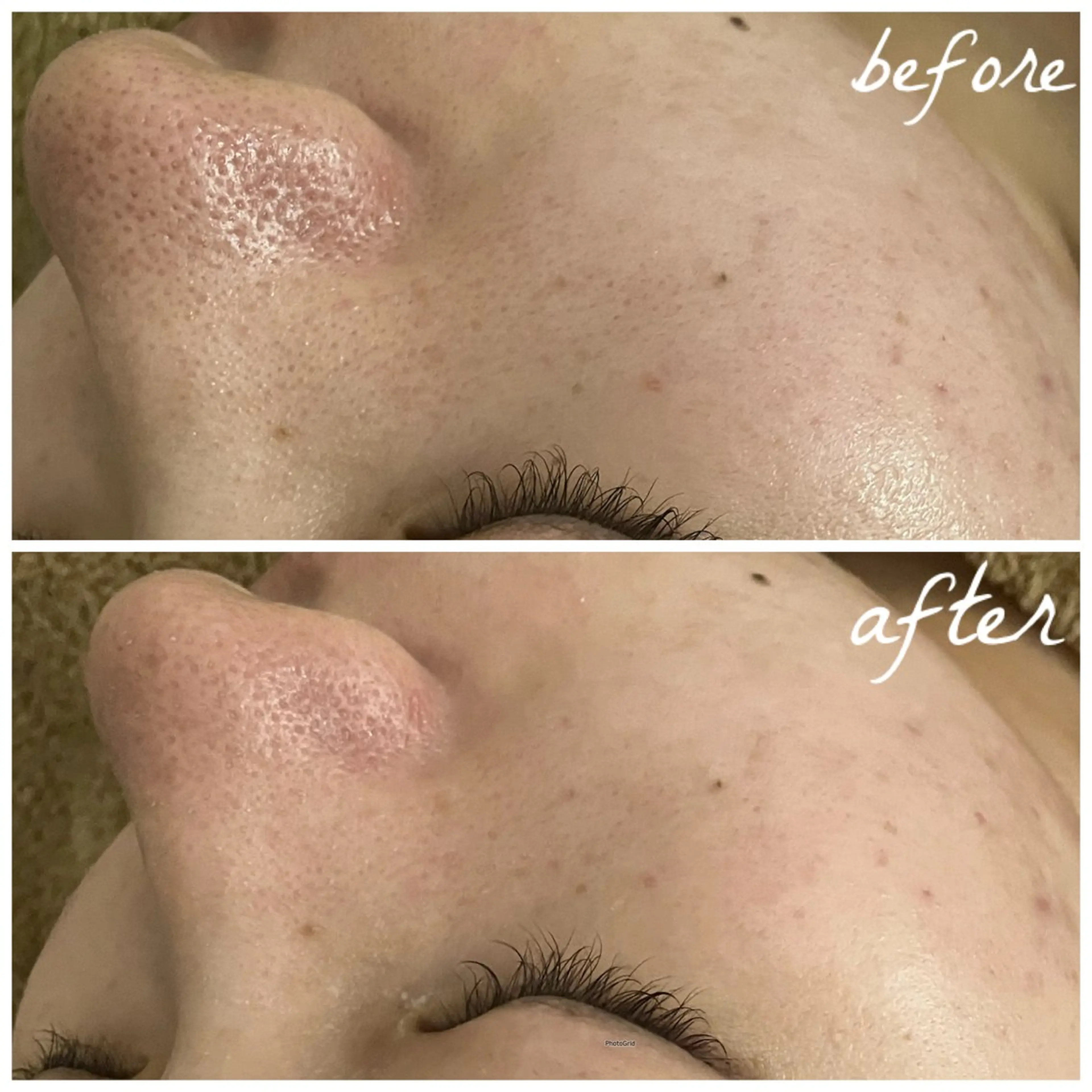 メンズ エステ メナード岐阜茜部 杉浦のエステ・リラクイメージ