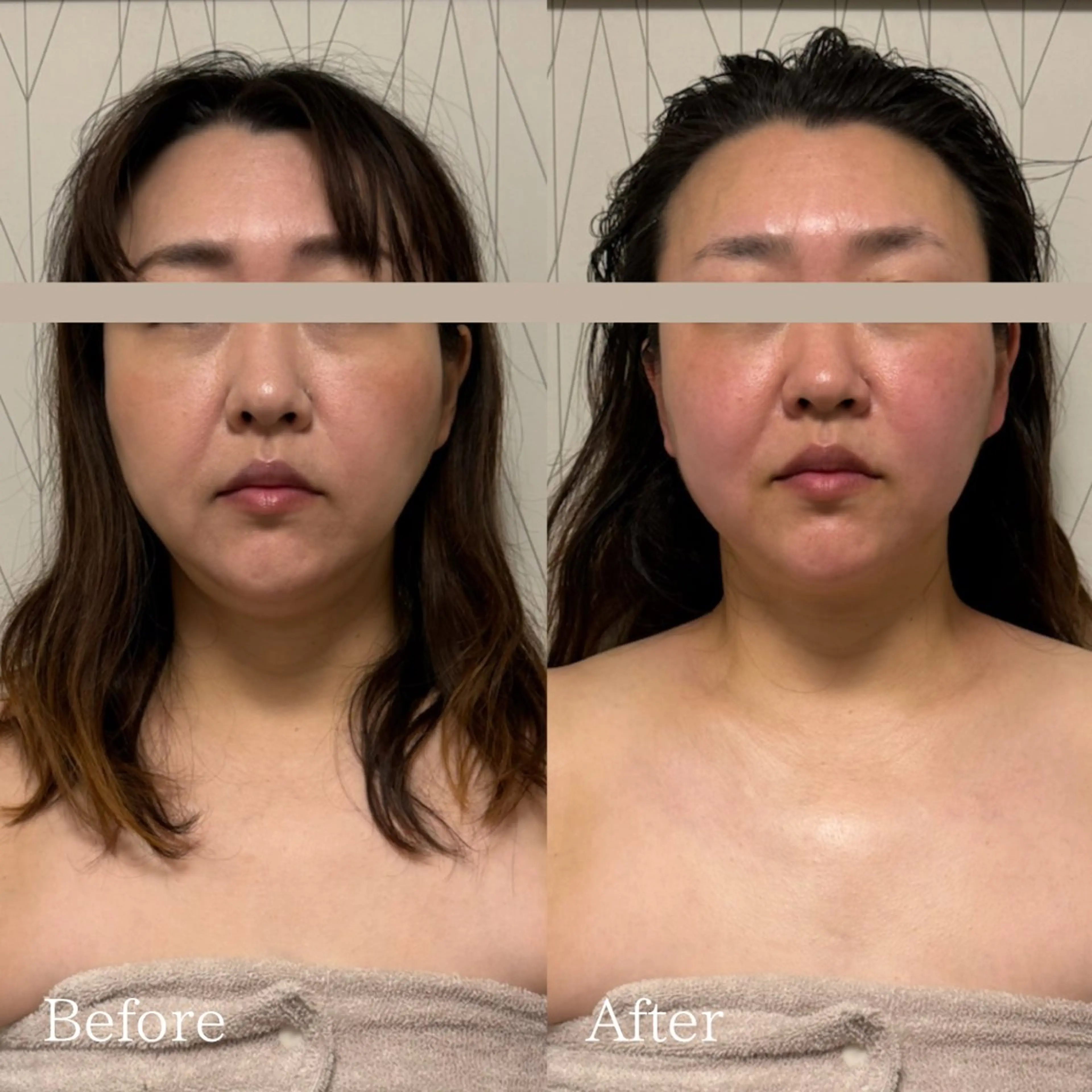 Lani Moon所属・⟡ 京都 小顔  ⊹ Lani Moonのエステ・リラクイメージ