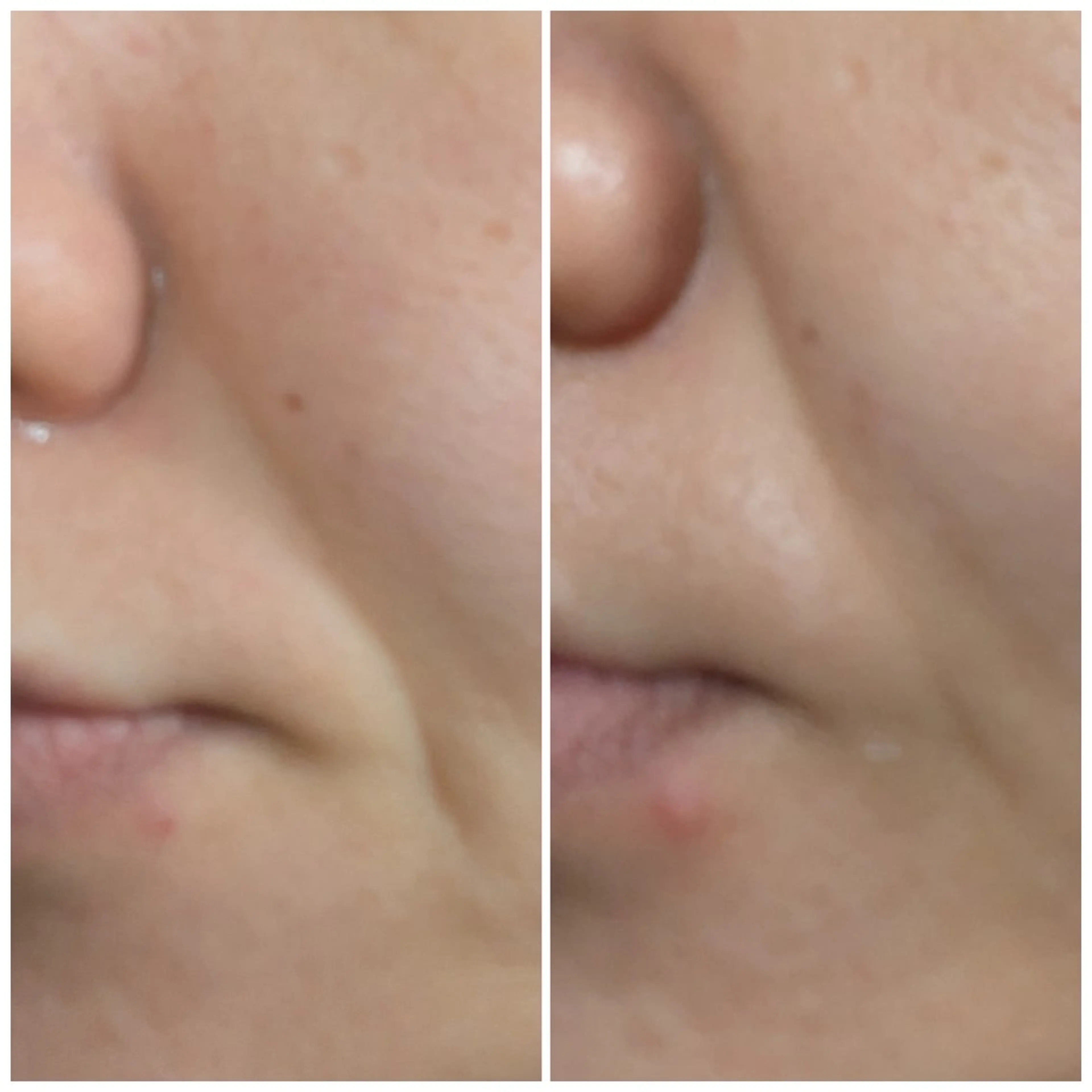 エステ 山城 春奈のエステ・リラクイメージ