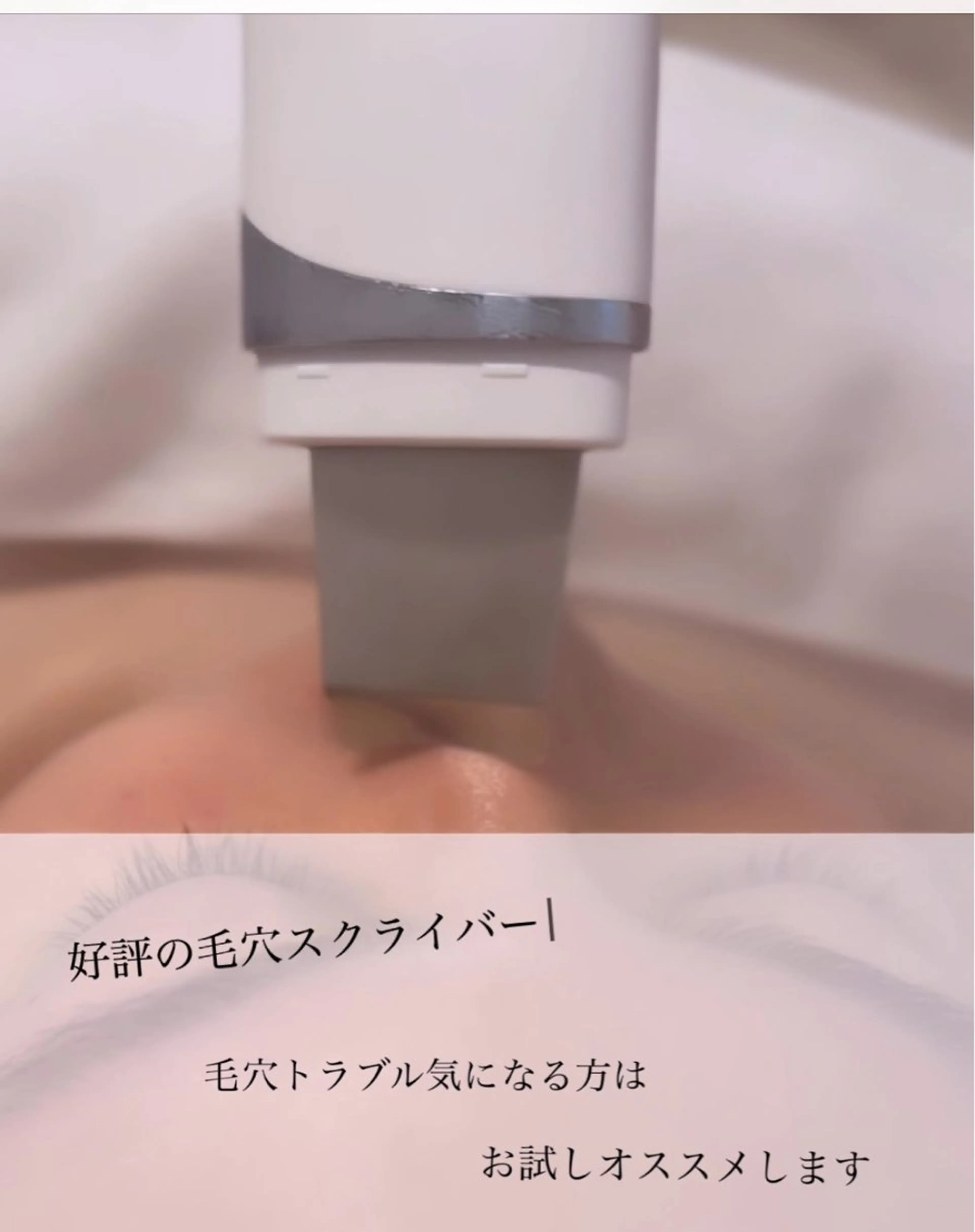 ナリスビューティサロンあべの所属・肌質改善/ツヤ肌作り /松本杏奈のエステ・リラクイメージ