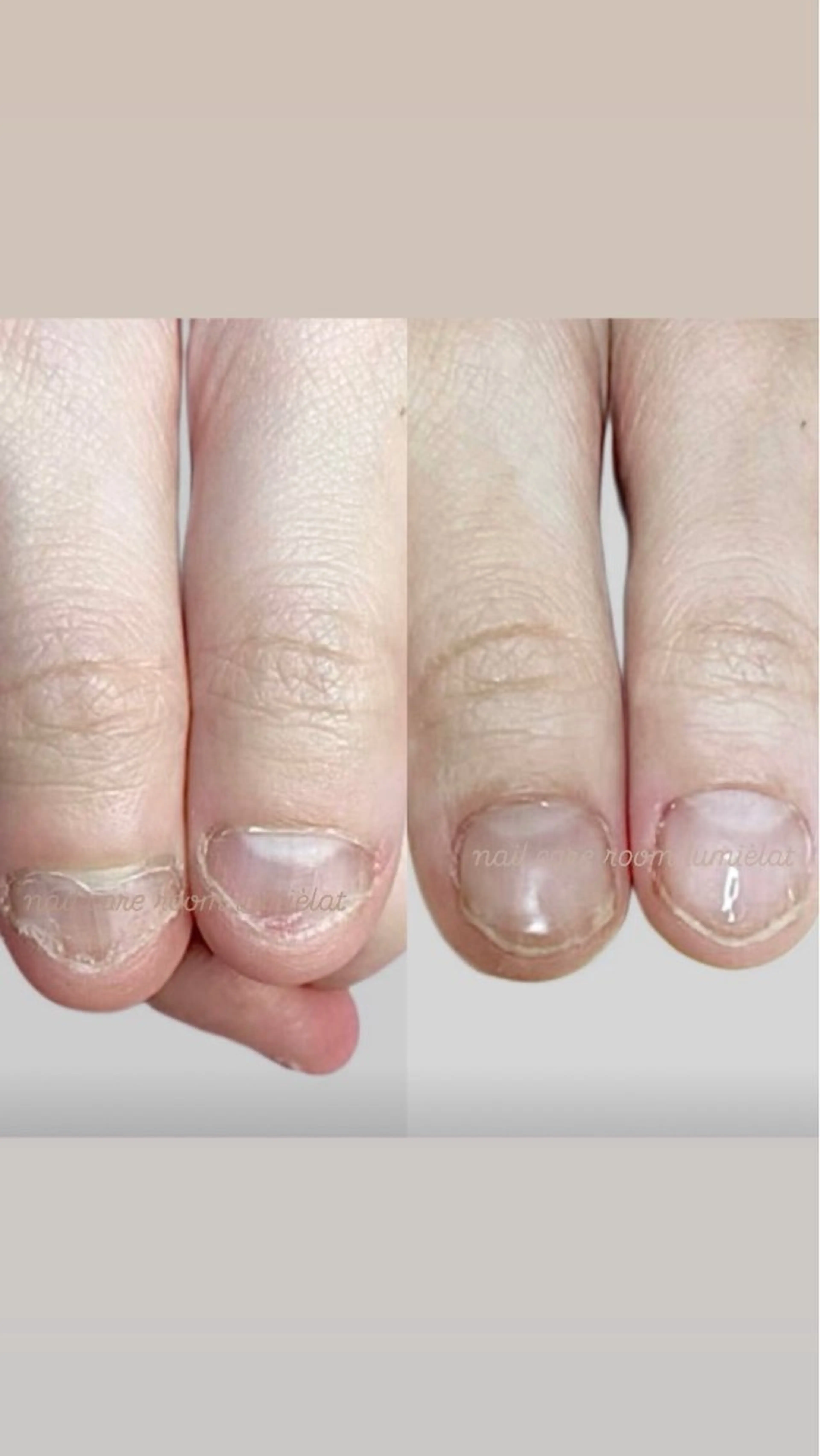ネイル 深爪育成専門nail _Lumièlatのネイルデザイン