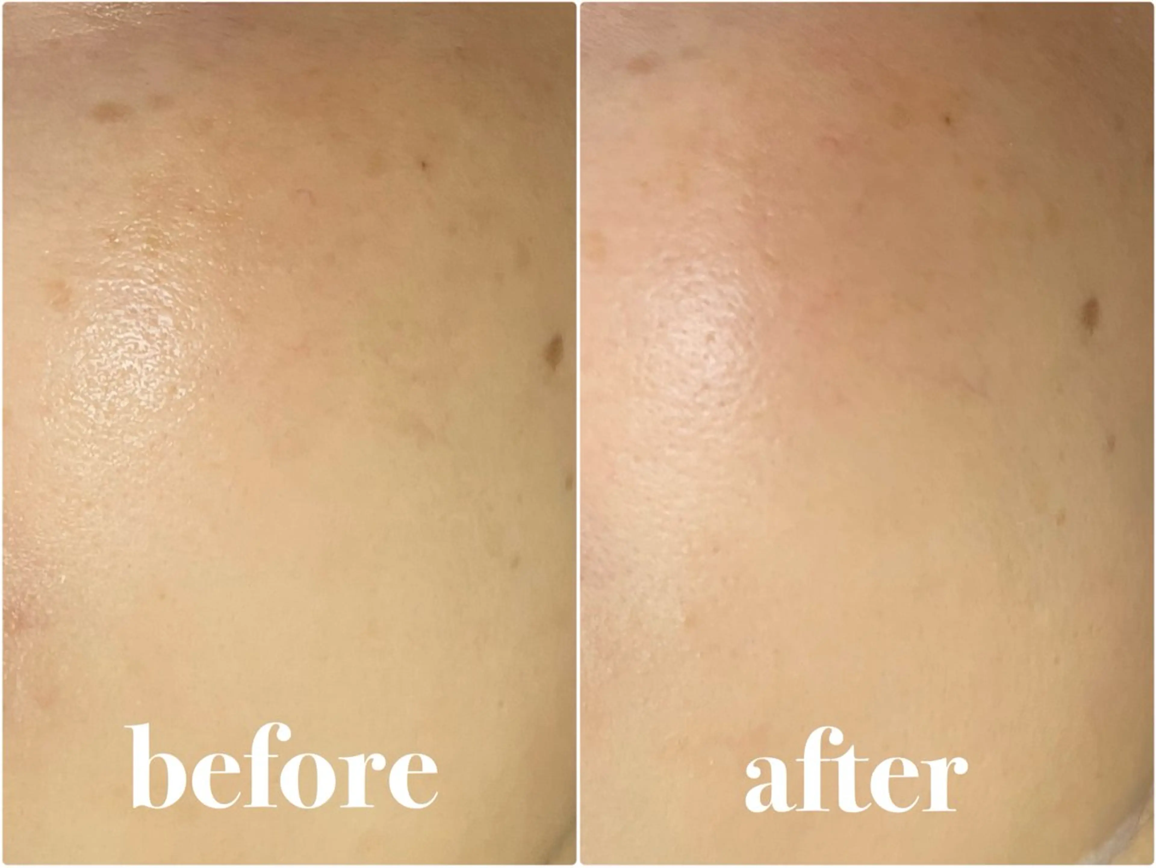 看護師が施術する 美容サロン/元治のエステ・リラクイメージ