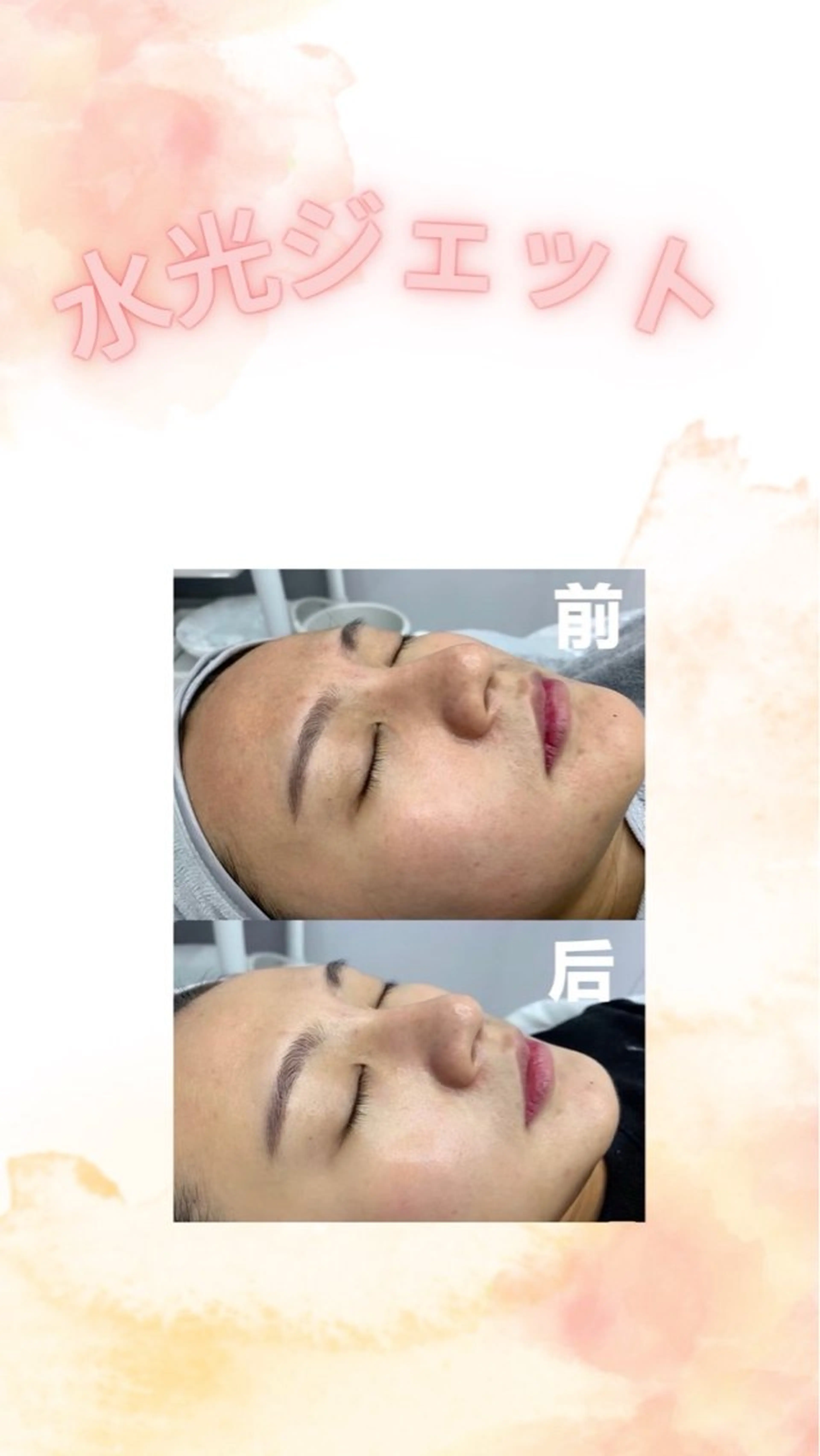 マツエク・マツパ エステ aliaハイフ&水光ジェットサロン所属・aliaハーブ水光店 エステティシャン募集のエステ・リラクイメージ