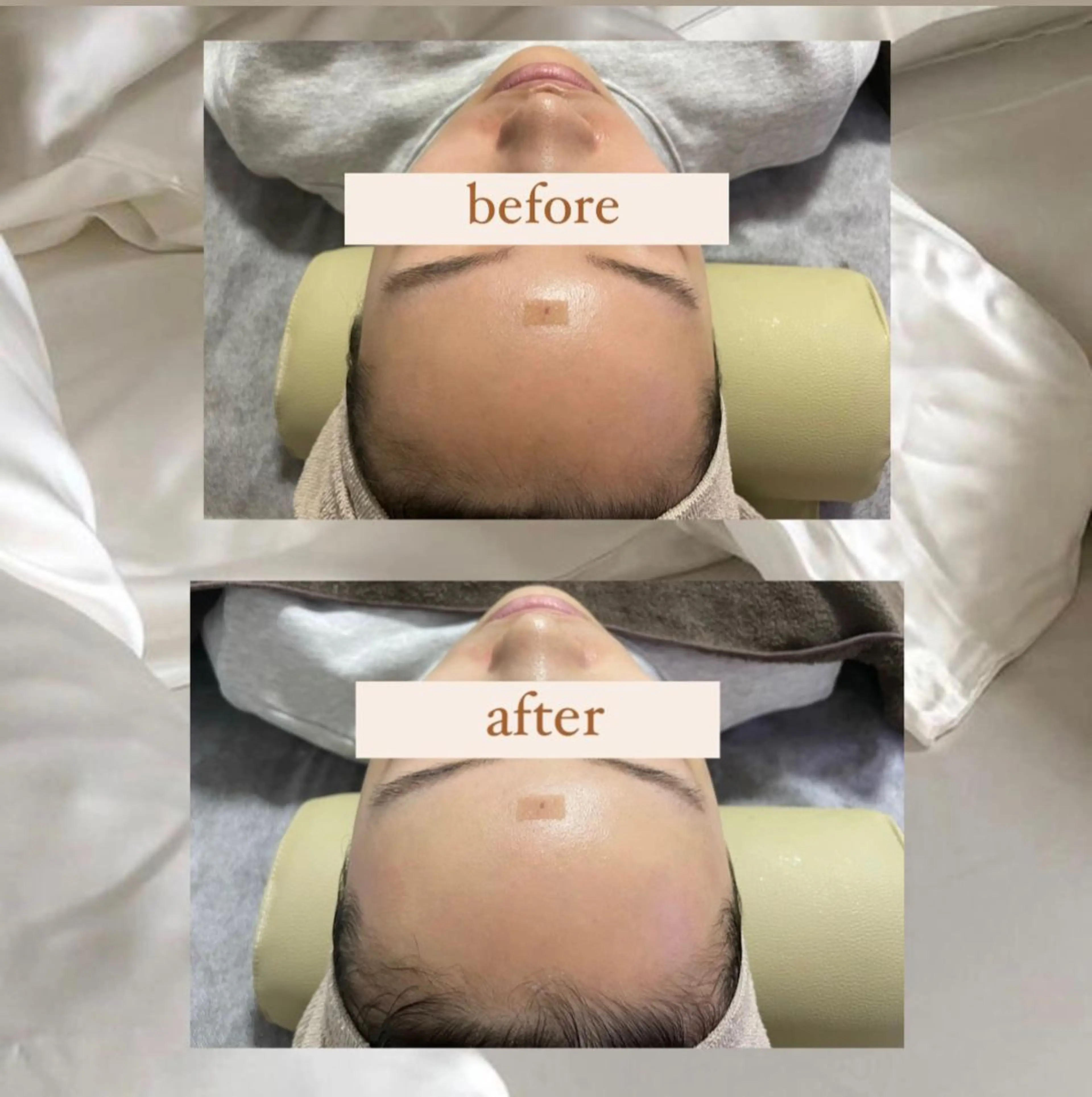 エステ crescent所属・【韓国肌管理・脱毛】 クレセントのその他イメージ