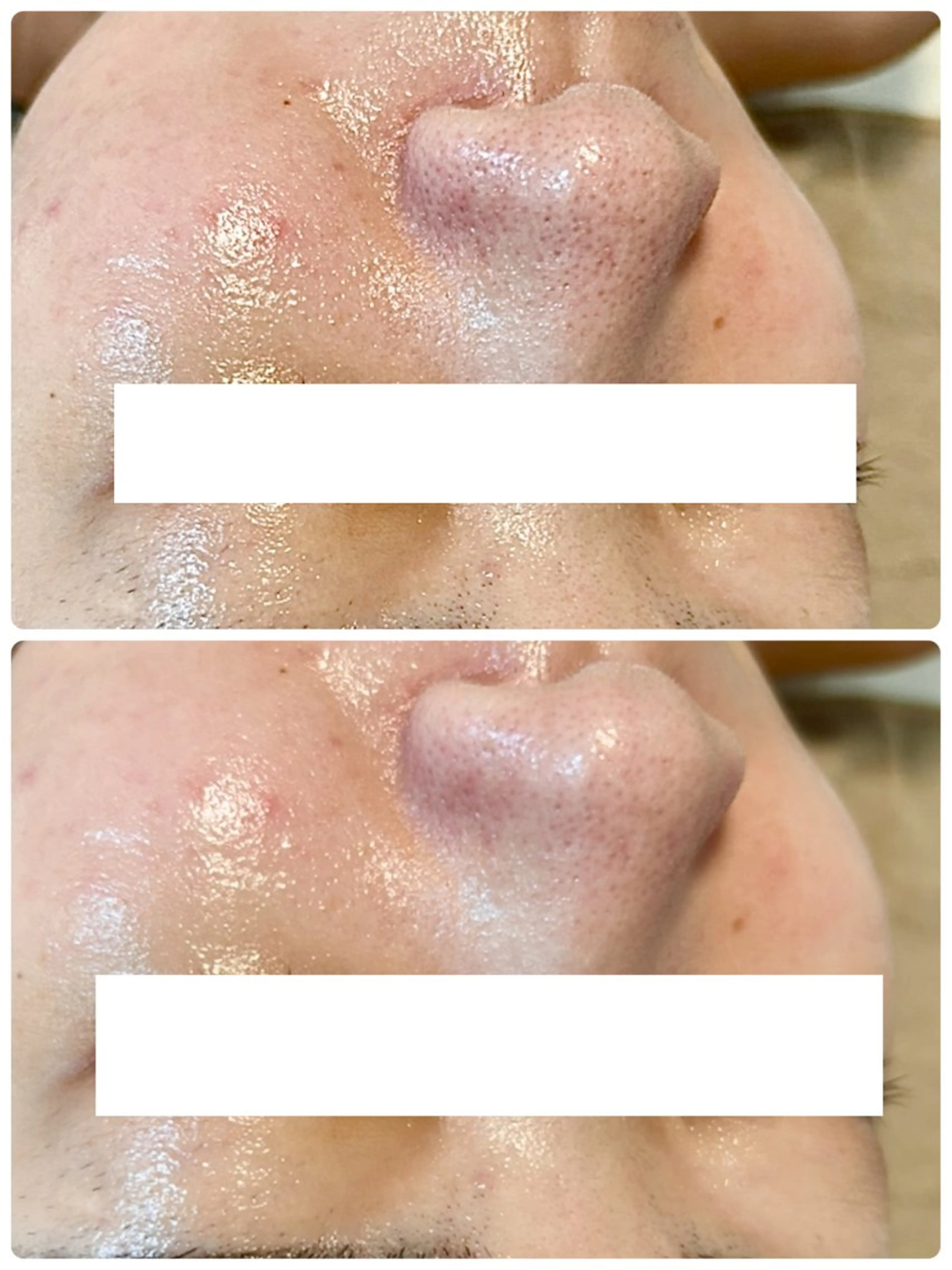 脱毛 Beauty salon Wish所属・脱毛🌈肌質改善🌈 Wishのエステ・リラクイメージ