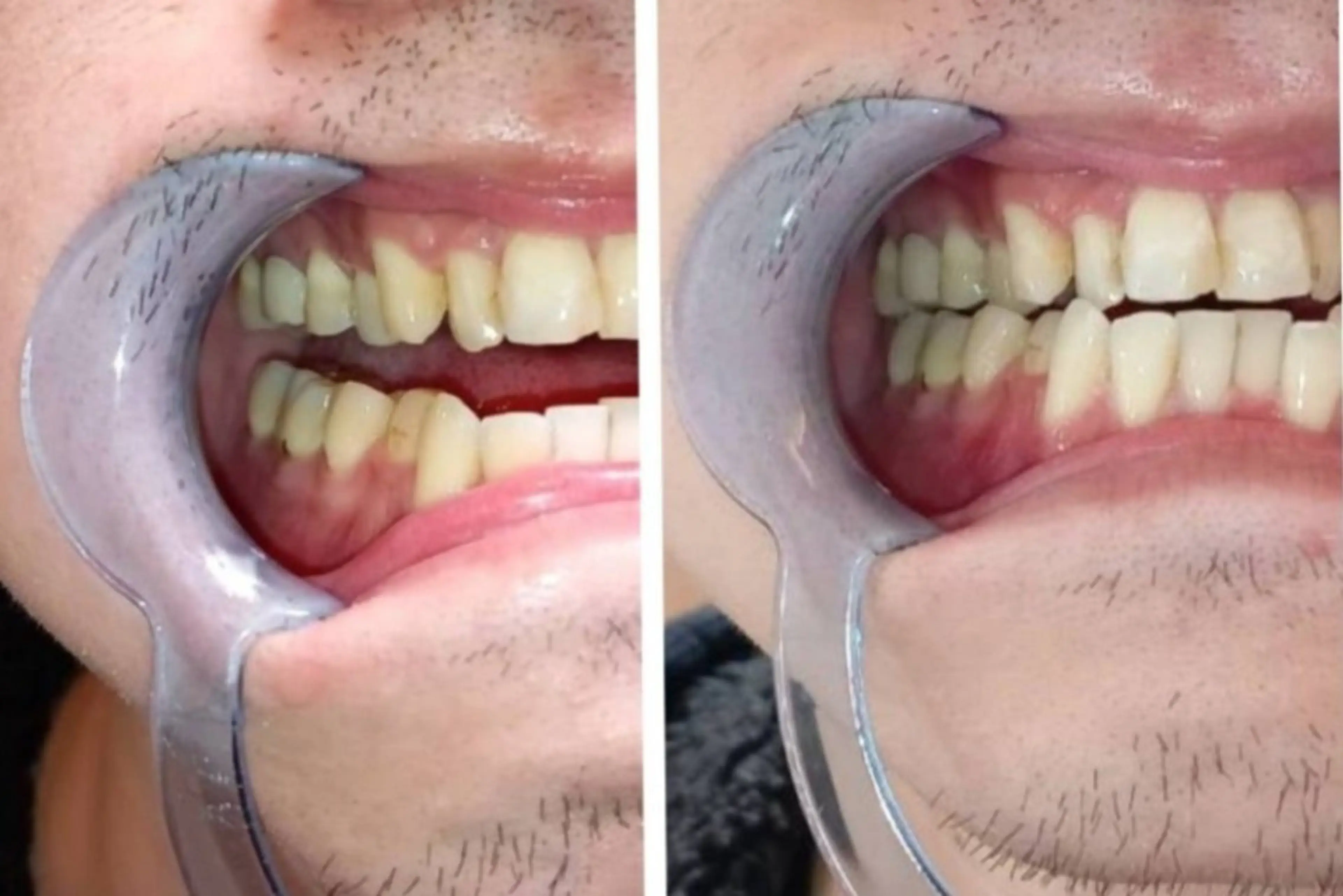 A-family所属・A-family  kaoriのエステ・リラクイメージ