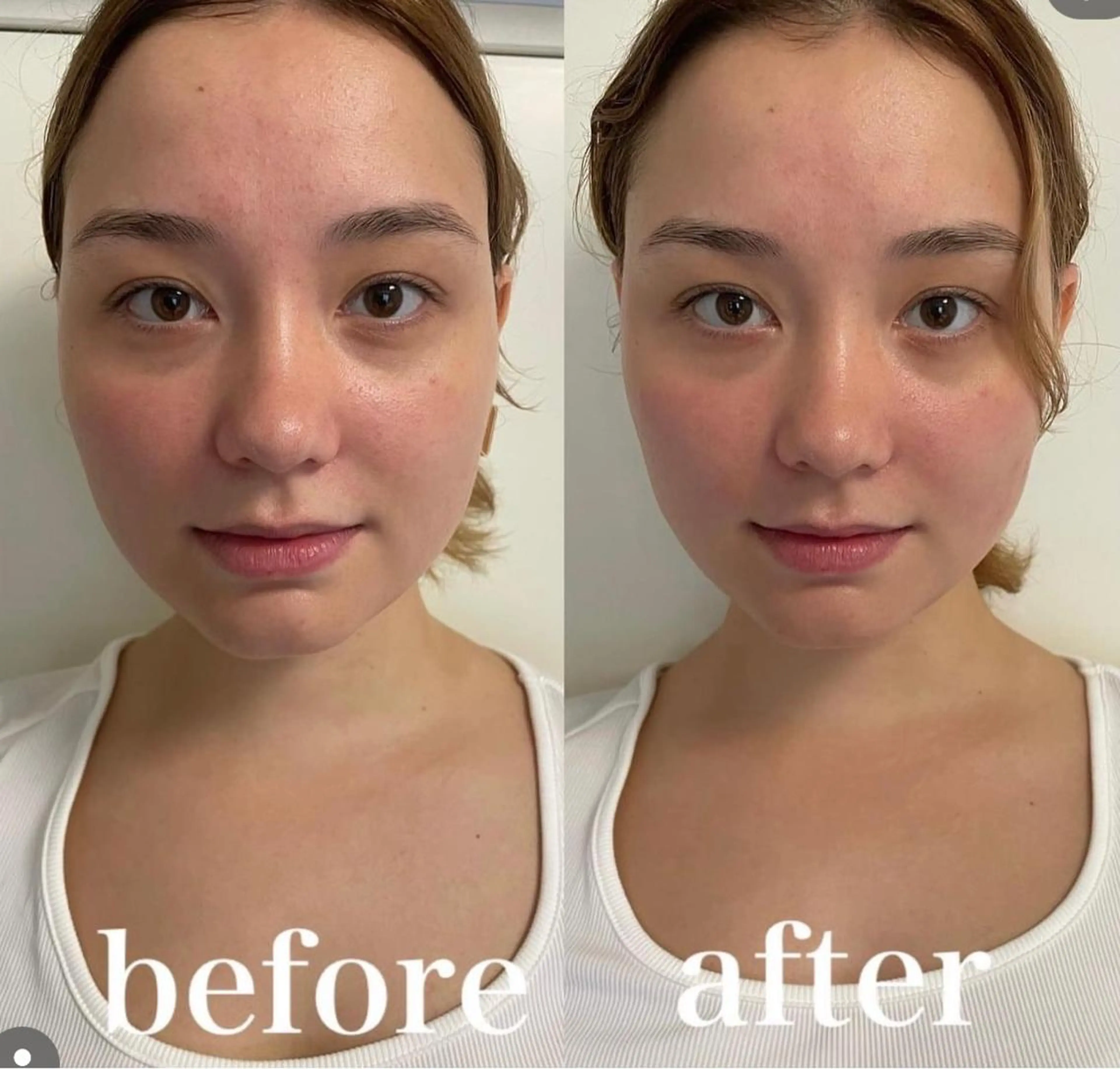 美容鍼灸サロン mahoroba院長のエステ・リラクイメージ