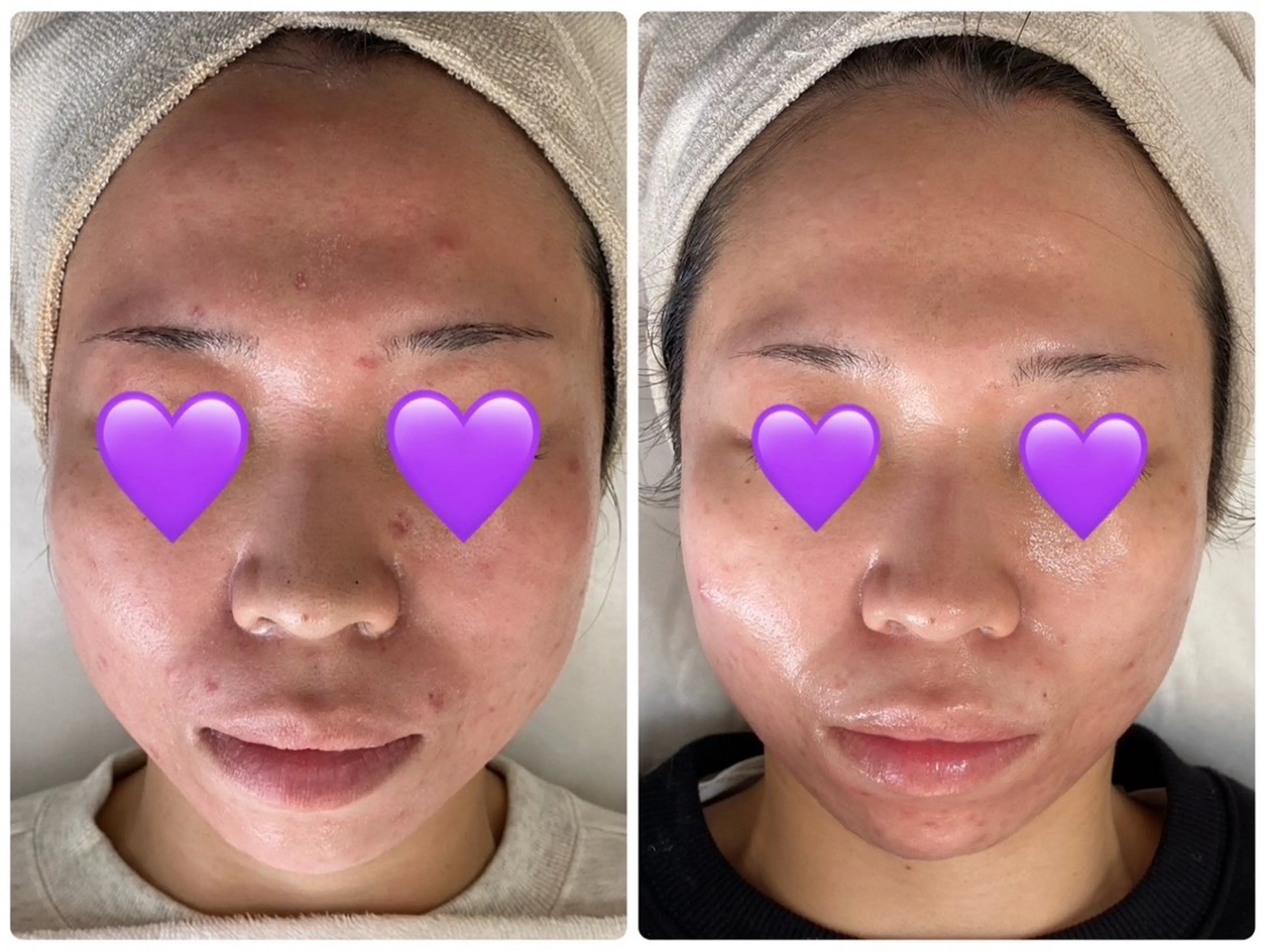 エステ De I'm トータルビューティーサロン所属・COCO beautyサロンのエステ・リラクイメージ