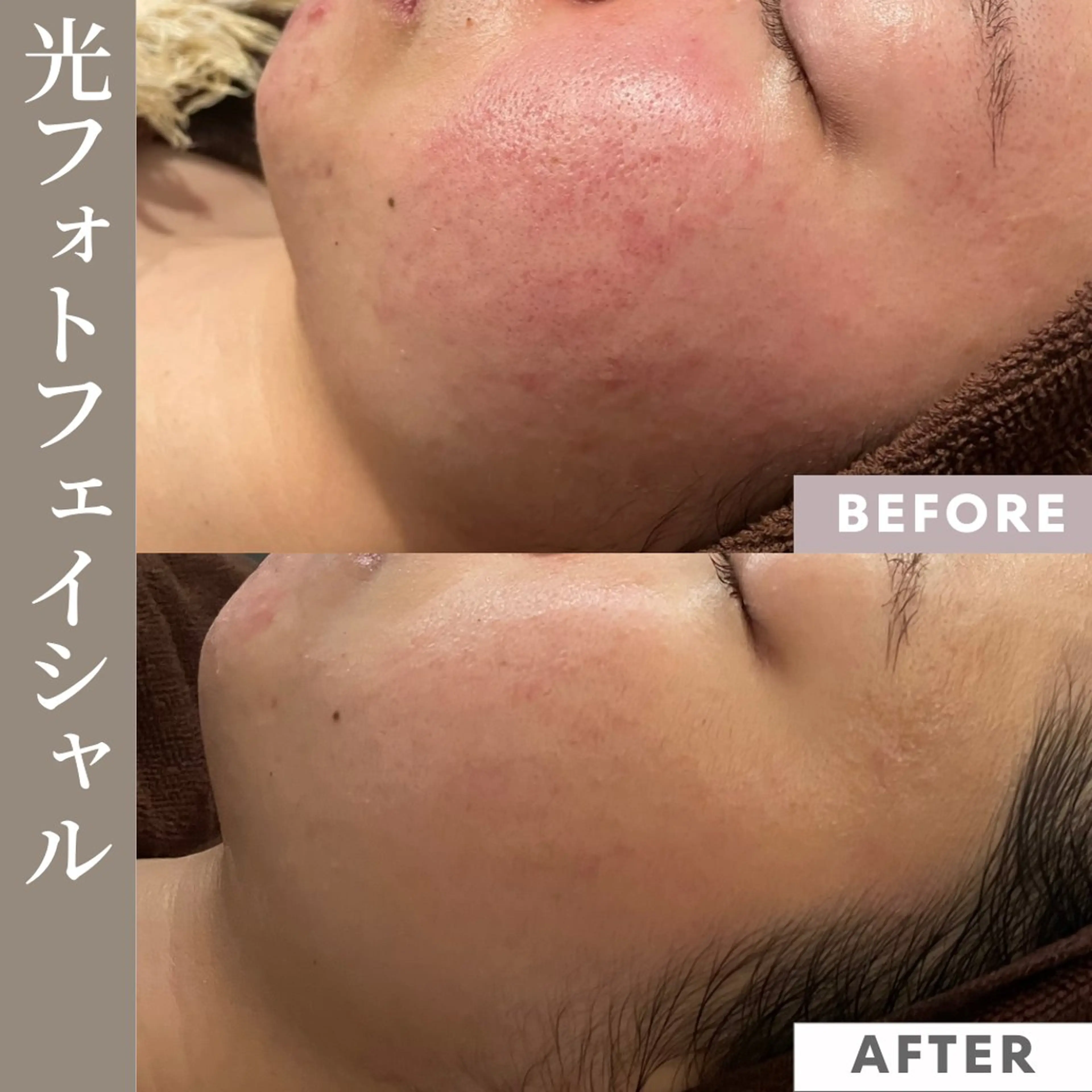 【フェムケア専門店】 PEQLIAヒロミのエステ・リラクイメージ