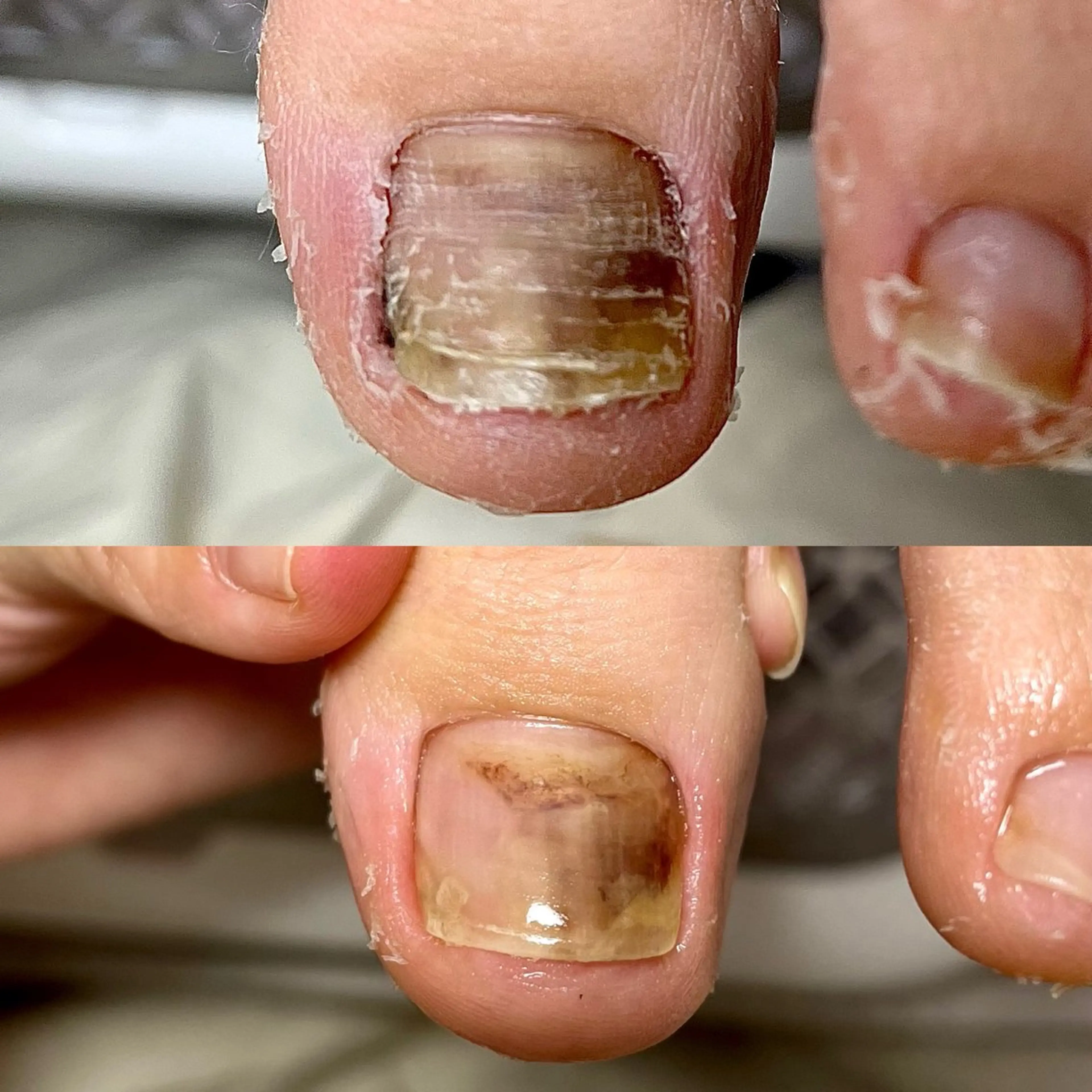 ネイル フットネイル rangrang nailのネイルデザイン