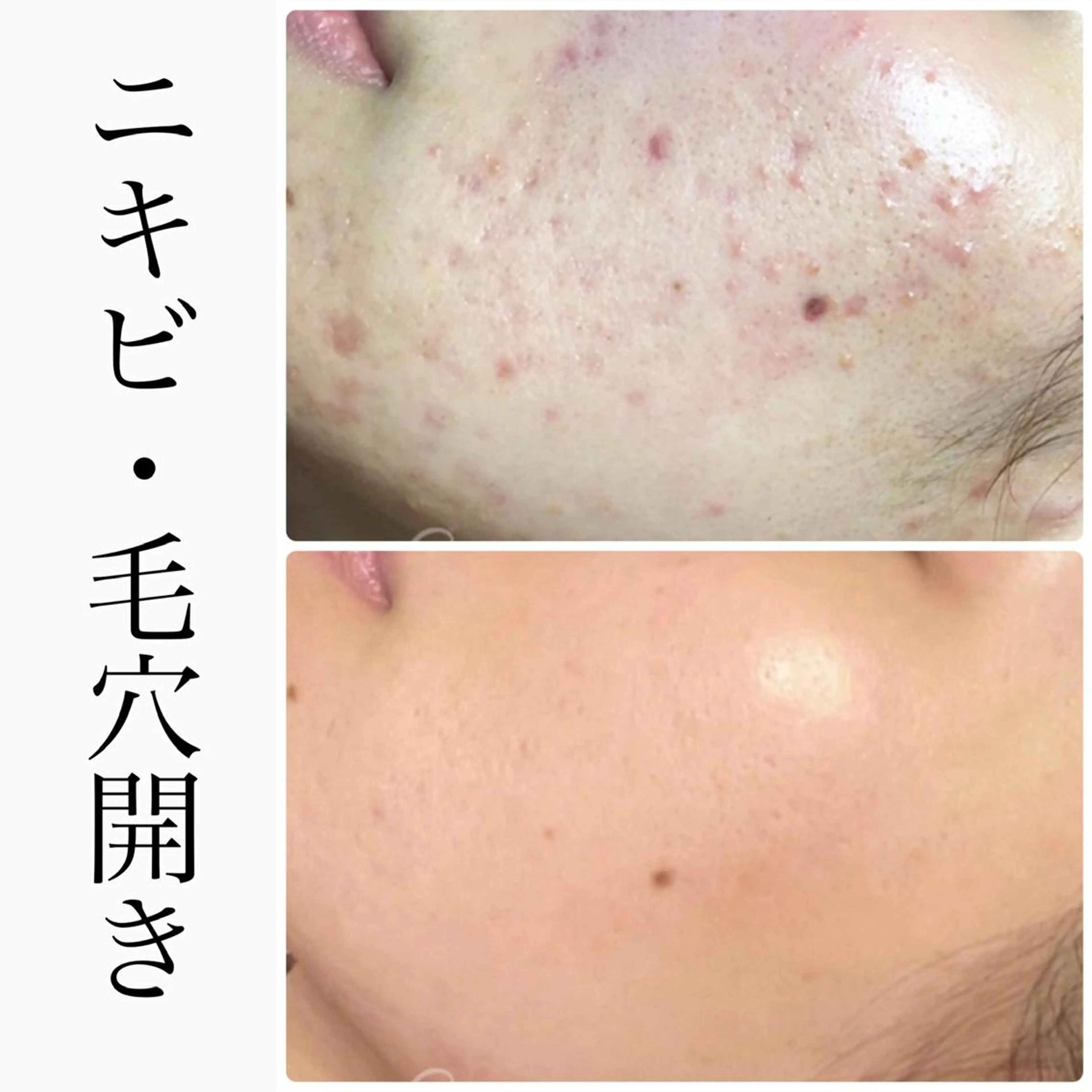 BeSkin藤沢店所属・ニキビ/肌質改善 BeSkin 藤沢店のエステ・リラクイメージ