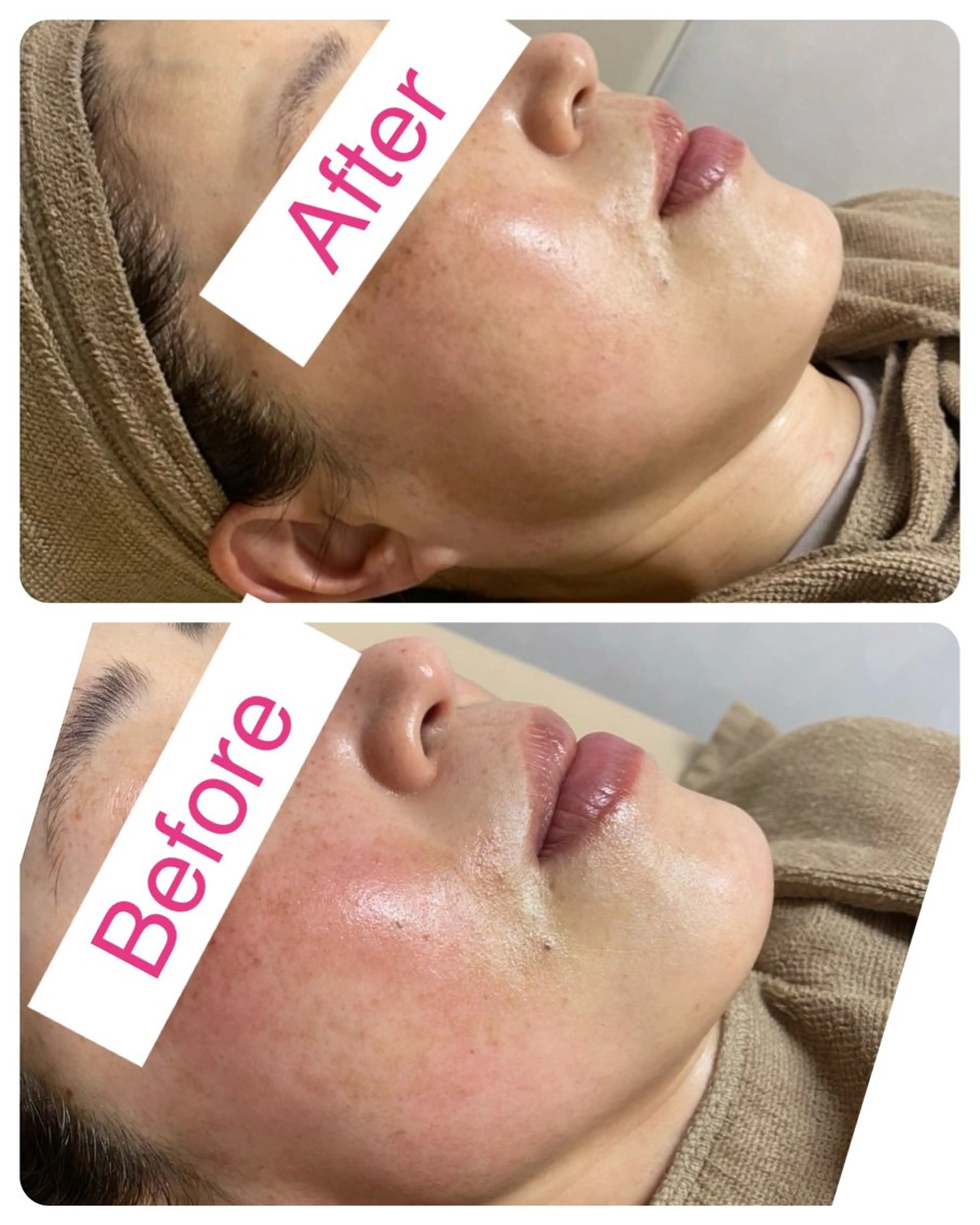 サロンドチェリー 《我妻》のエステ・リラクイメージ