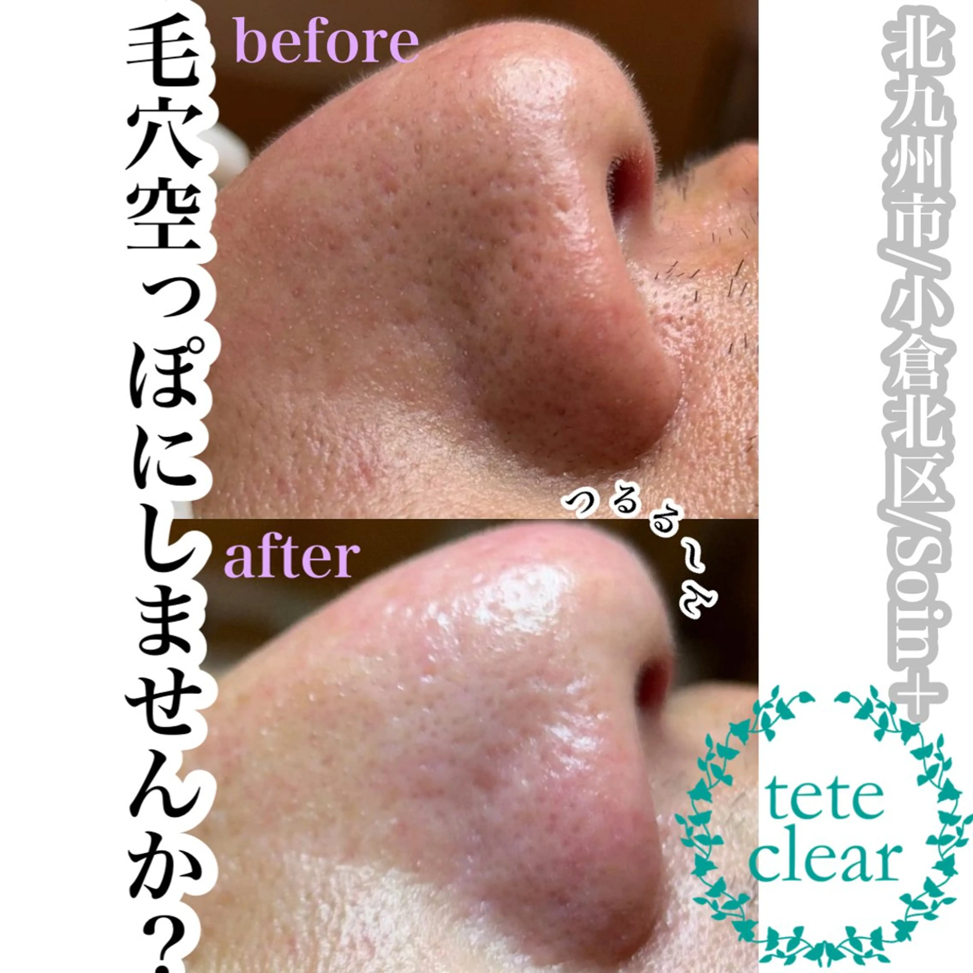 Soin＋ みきのエステ・リラクイメージ