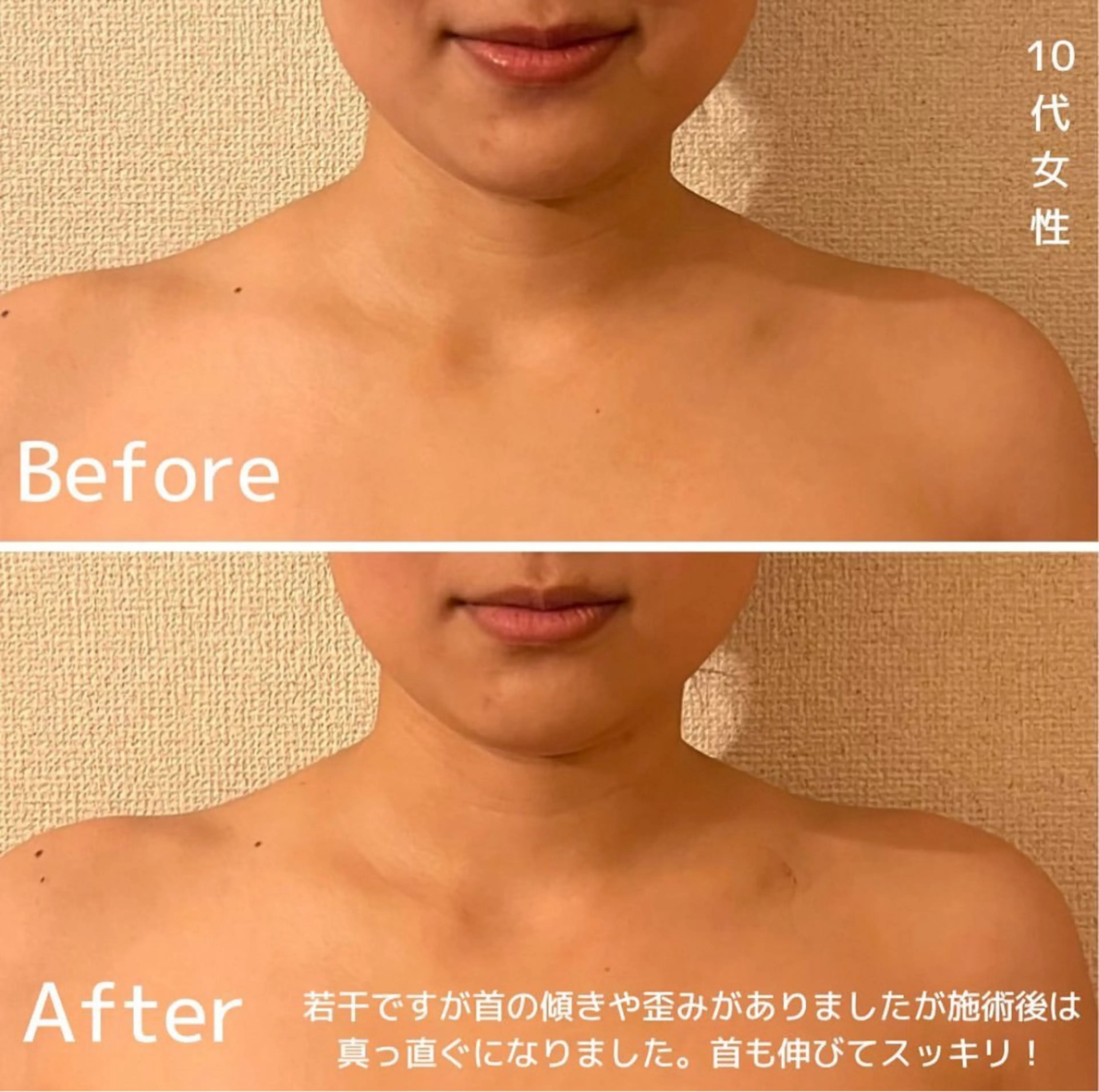 エステ リラク 表情筋フェイシャル 三軒茶屋のエステ・リラクイメージ