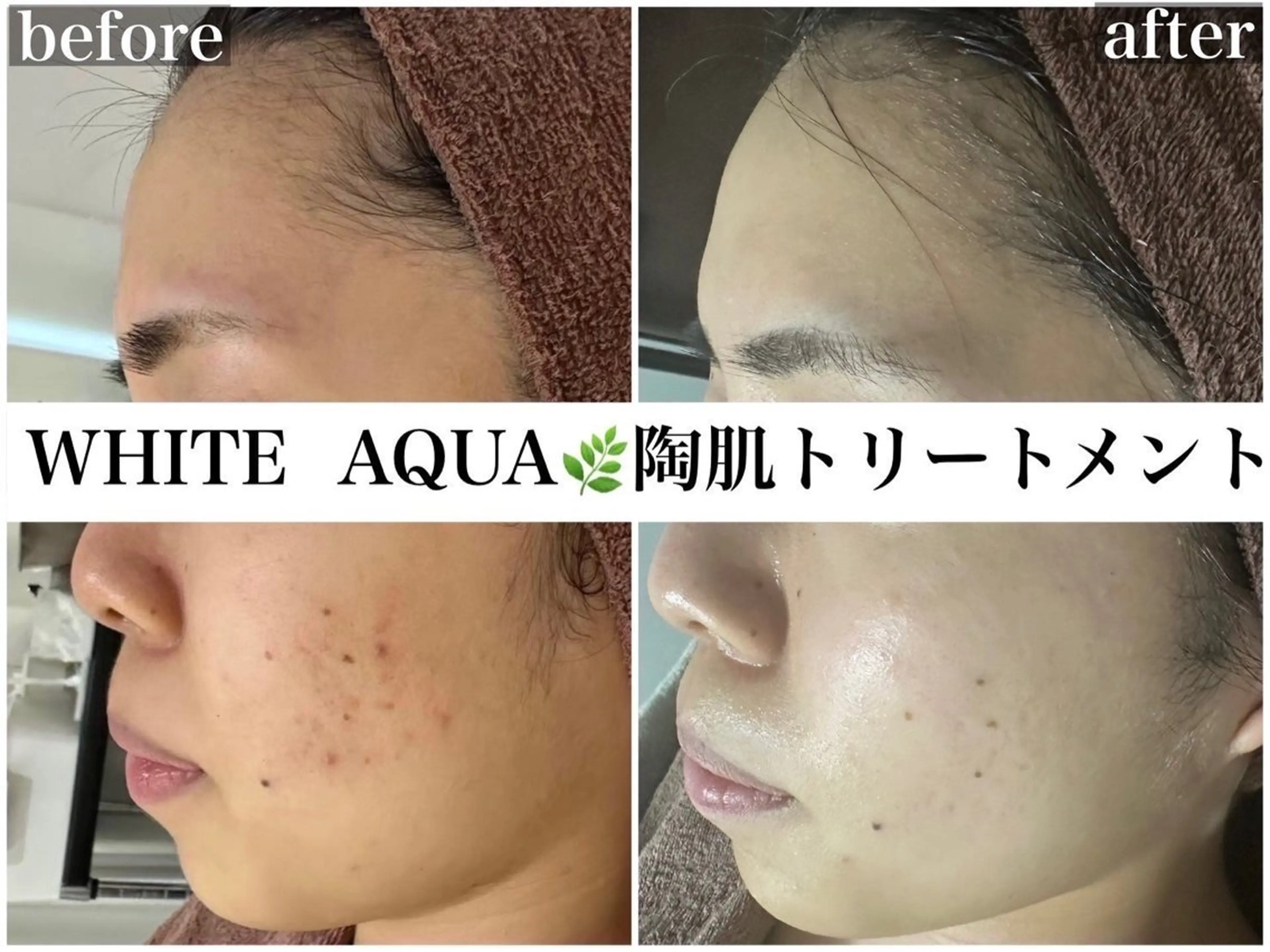 中目黒ハーブピーリン グ🌿ララピールのエステ・リラクイメージ